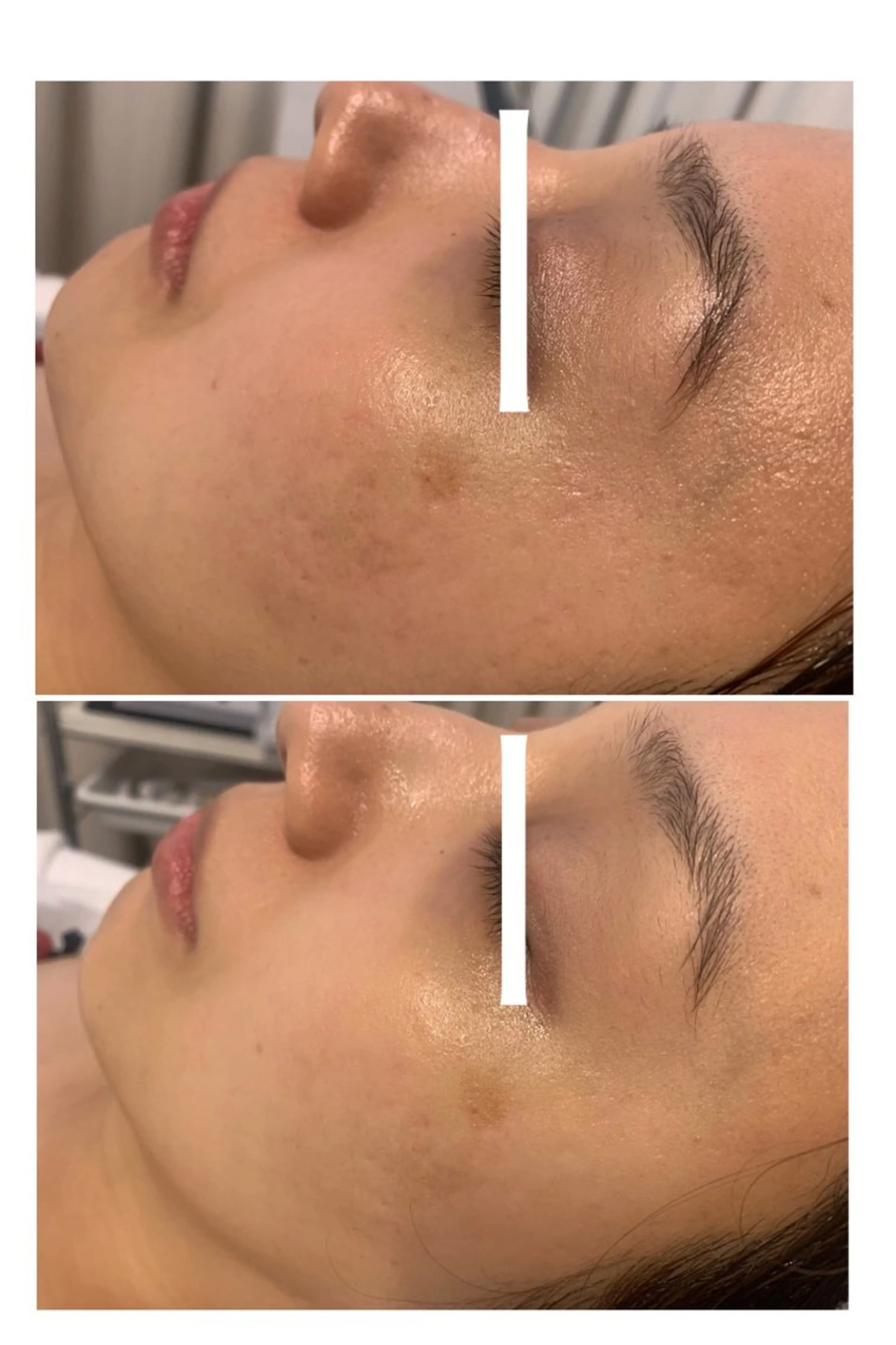 エステ リラク ナリスビューティサロンあべの所属・肌質改善/ツヤ肌作り /松本杏奈のエステ・リラクイメージ