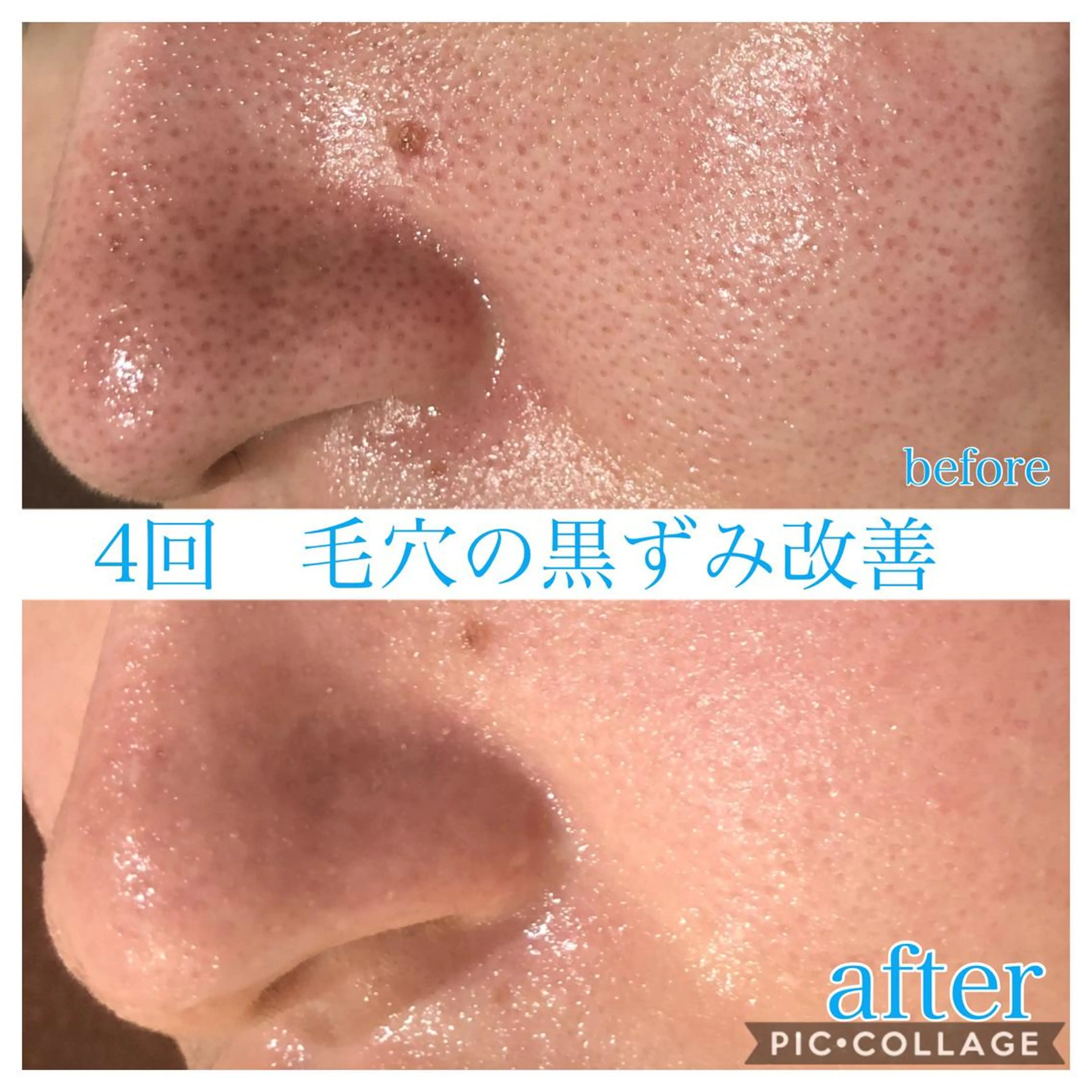 ミディアム カラー パーマ ヘアアレンジ メンズ キッズ ネイル マツエク・マツパ エステ リラク Ensor Clair所属・EnsorClair 代表　野口真央のエステ・リラクイメージ