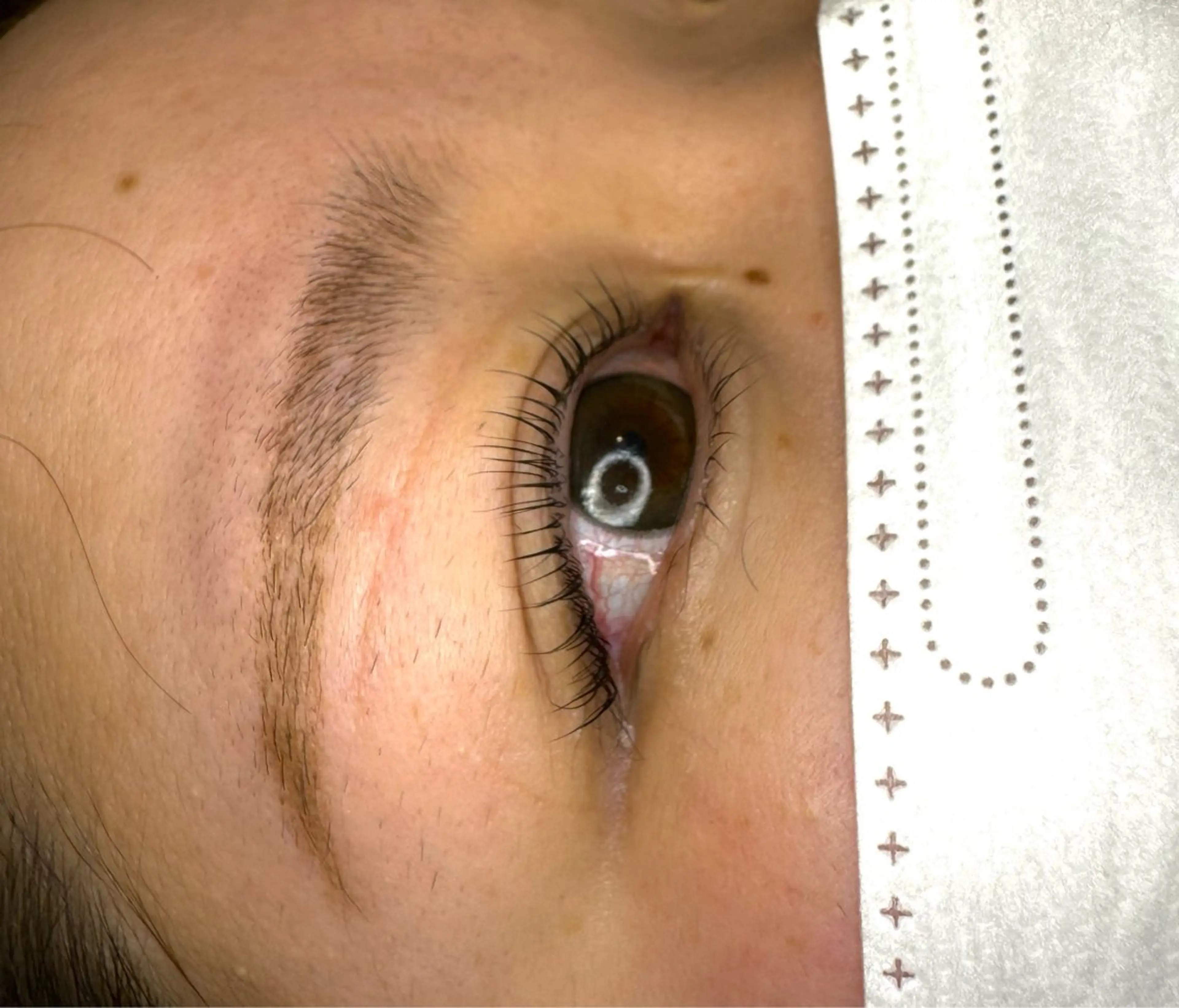 マツエク・マツパ Amaranth所属・Lupinus 小顔矯正のエステ・リラクイメージ