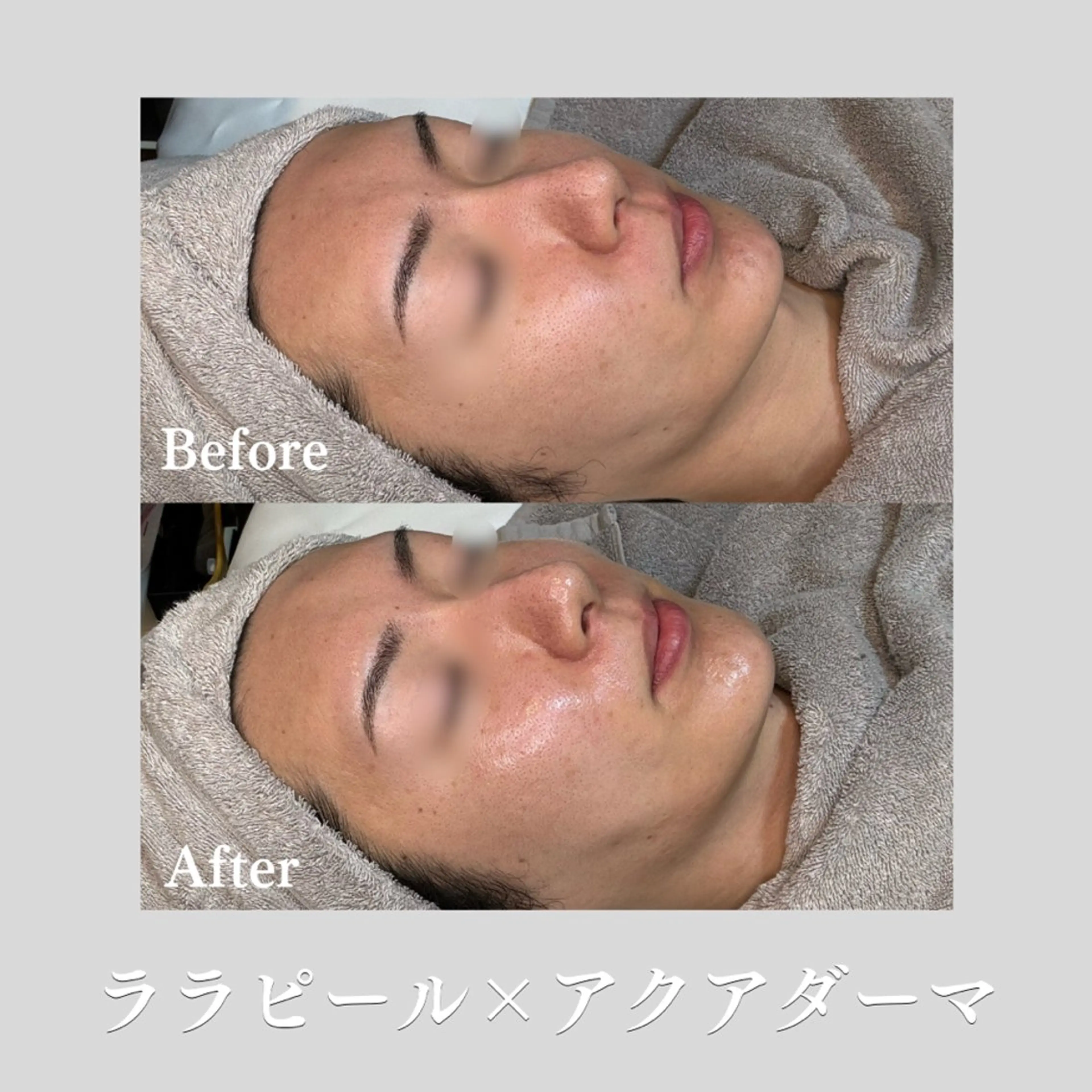 看護師が施術する ナスサロ/Emi🪽のエステ・リラクイメージ