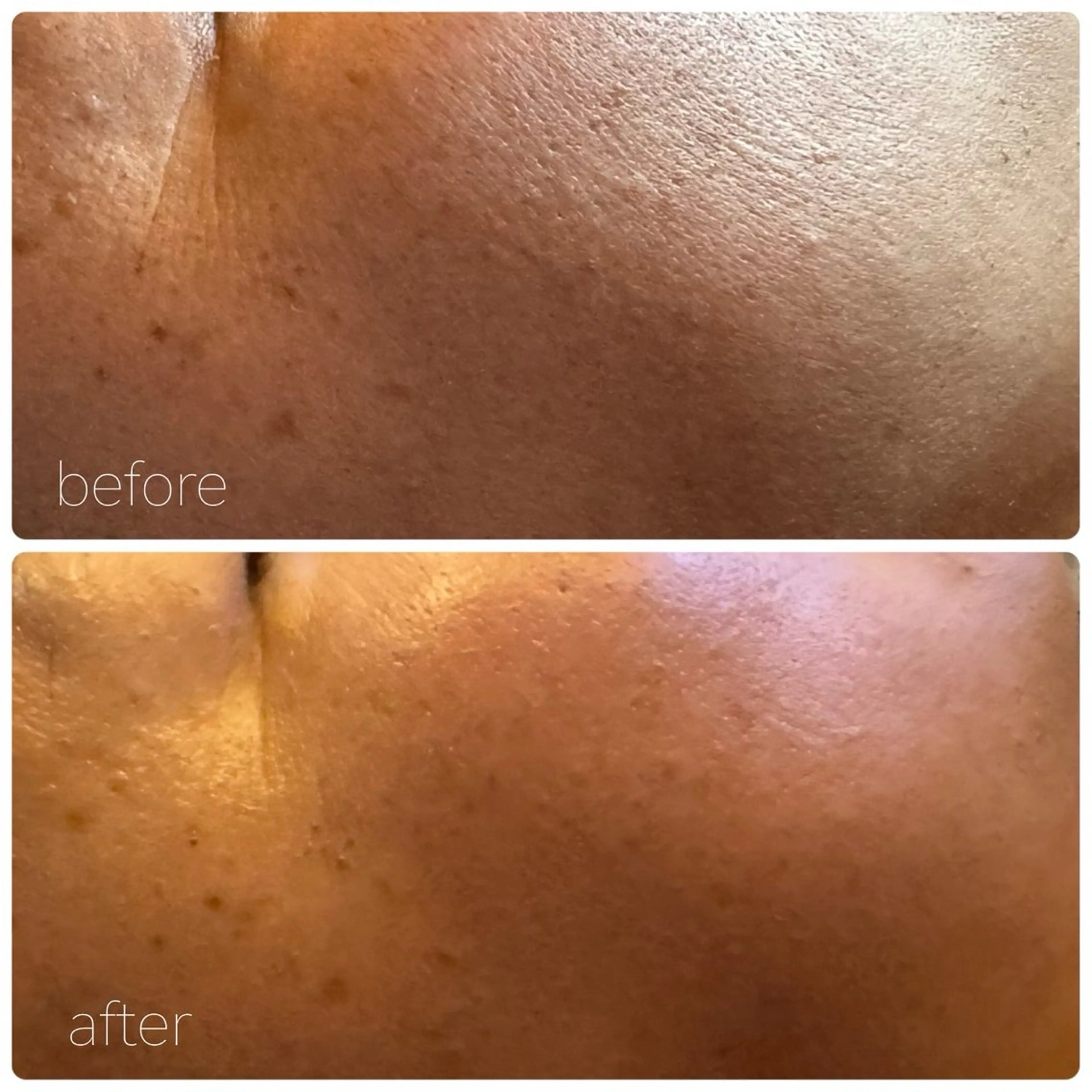 エステ HALU _HARUのエステ・リラクイメージ