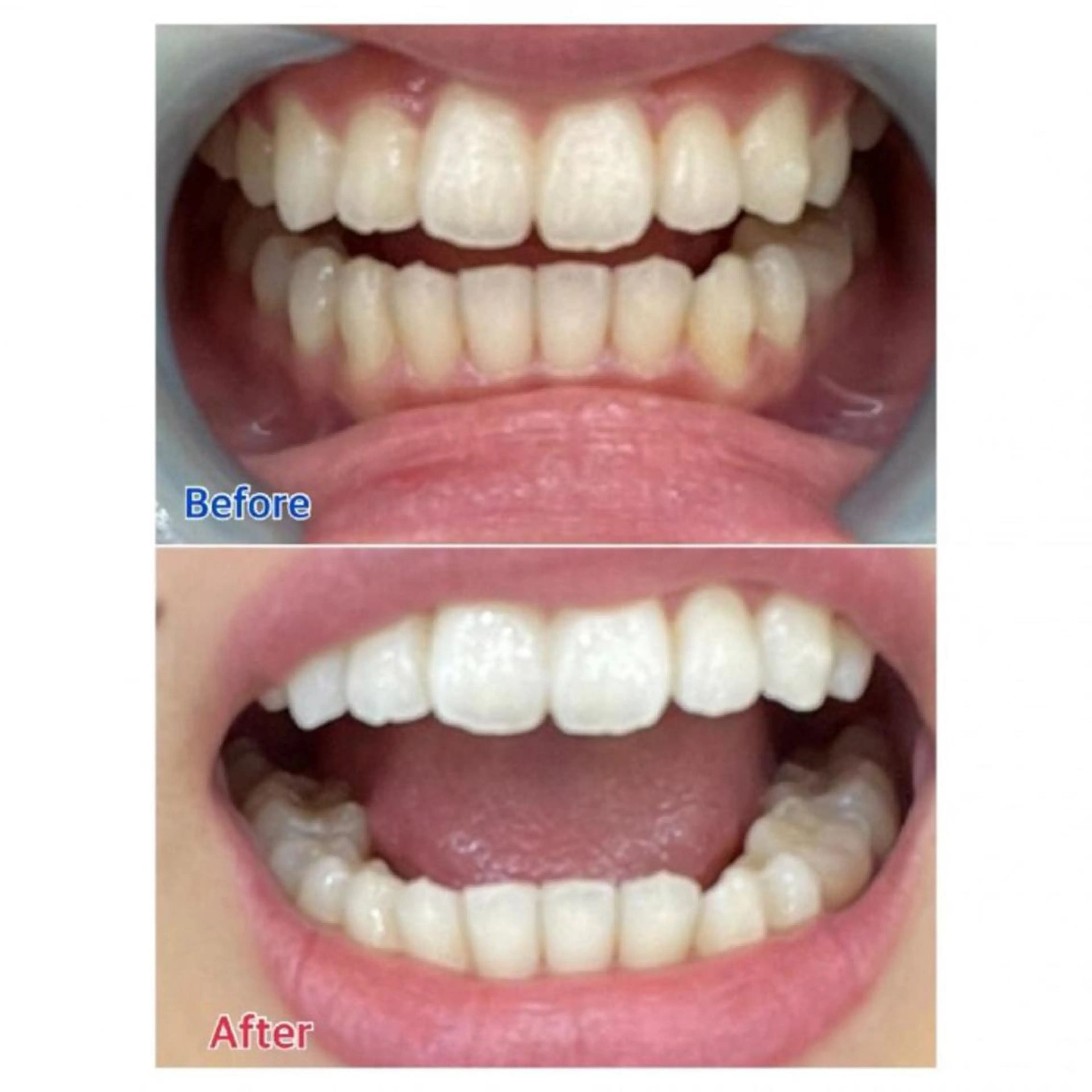 M渋谷店所属・Ｍ渋谷 ホワイトニングのエステ・リラクイメージ