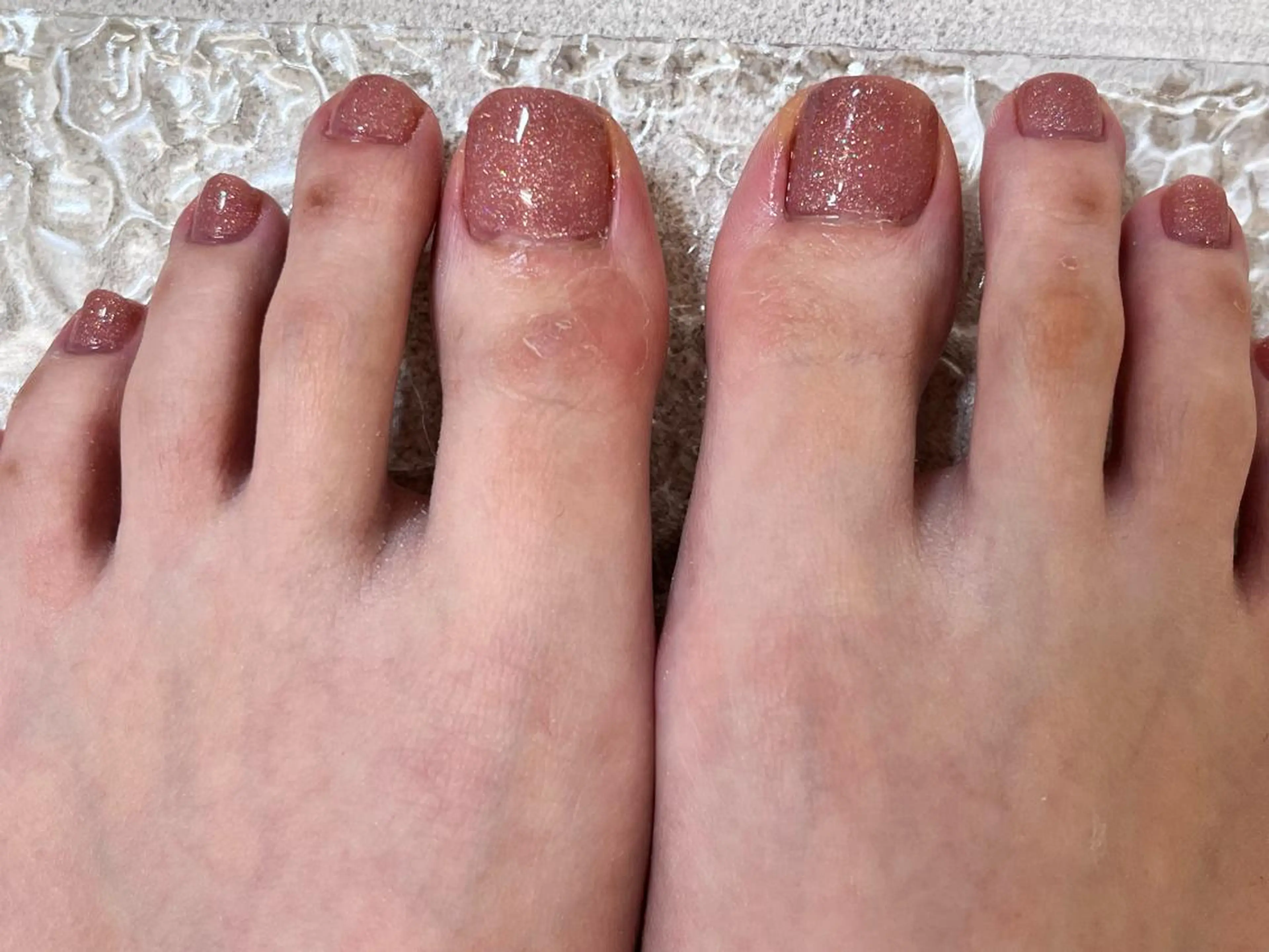 ネイル フットネイル ラメ(グリッター) ピンク ネイルサロンエーナイン平岸店所属・齋藤 英理のネイルデザイン