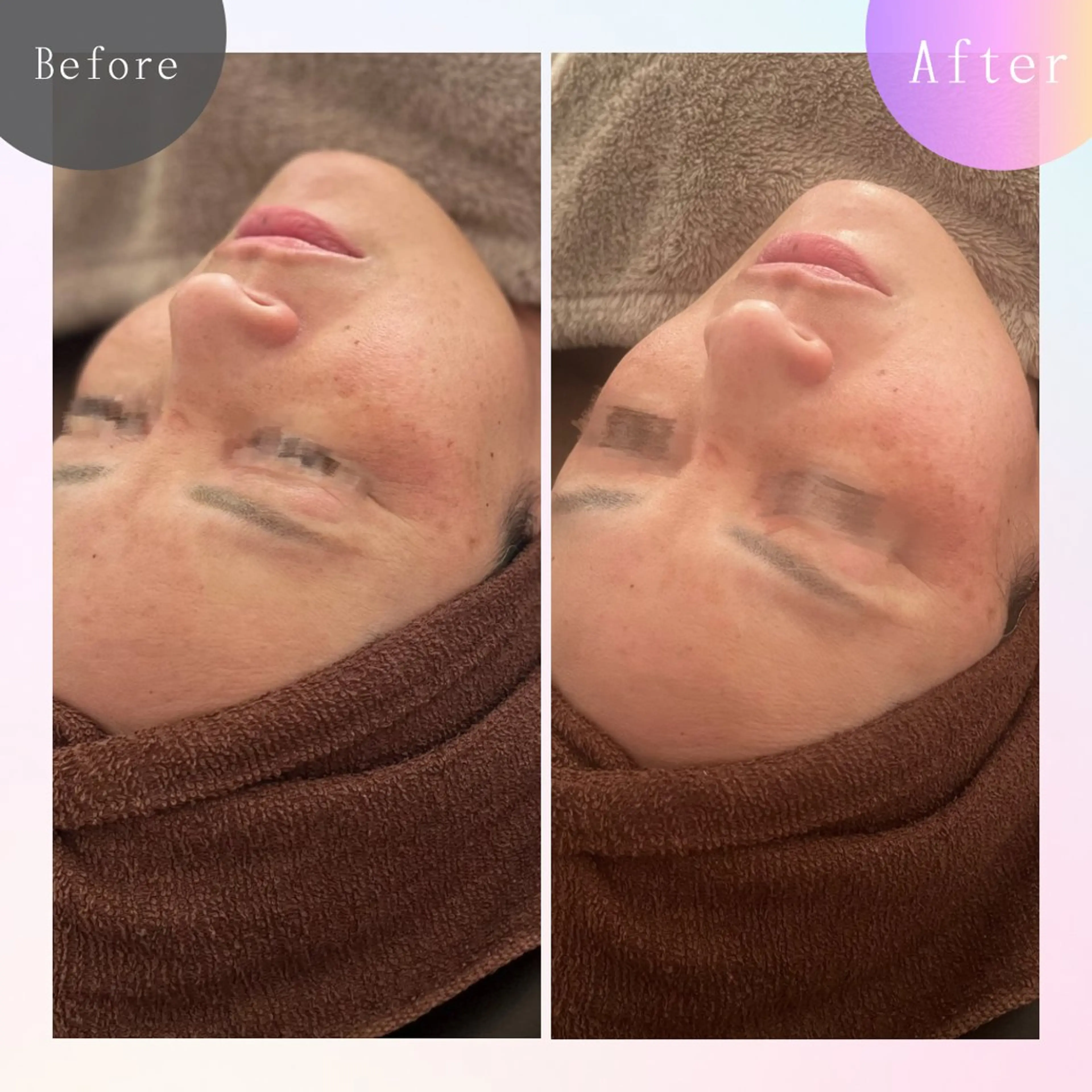 小顔リンパ 🕊️の写真