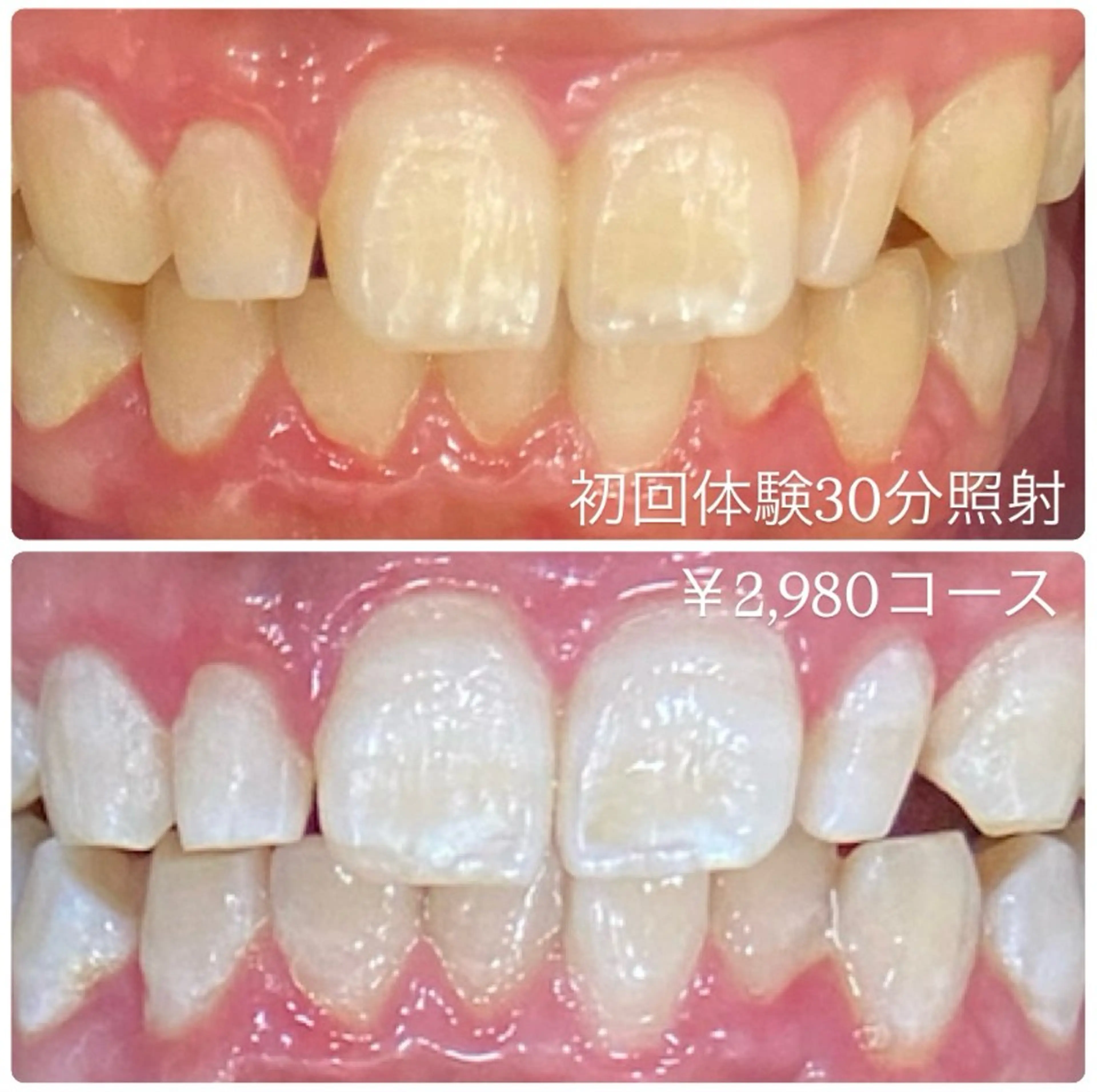 PLATINUM Beauty 横浜店所属・ホワイトニングルーム 横浜店のその他イメージ