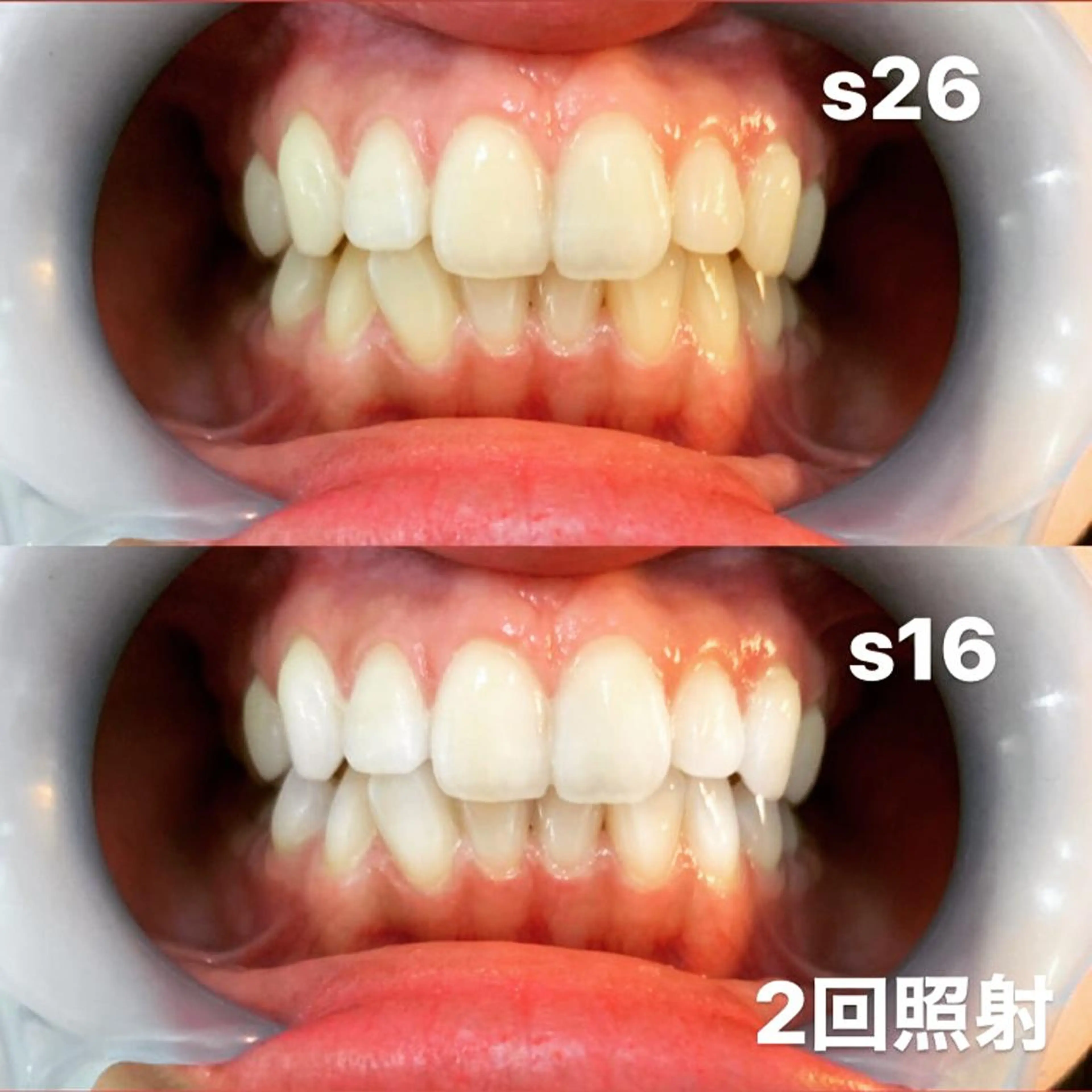 その他 LOVEホワイトニング表参道店所属・LOVE ホワイトニング表参道のその他イメージ