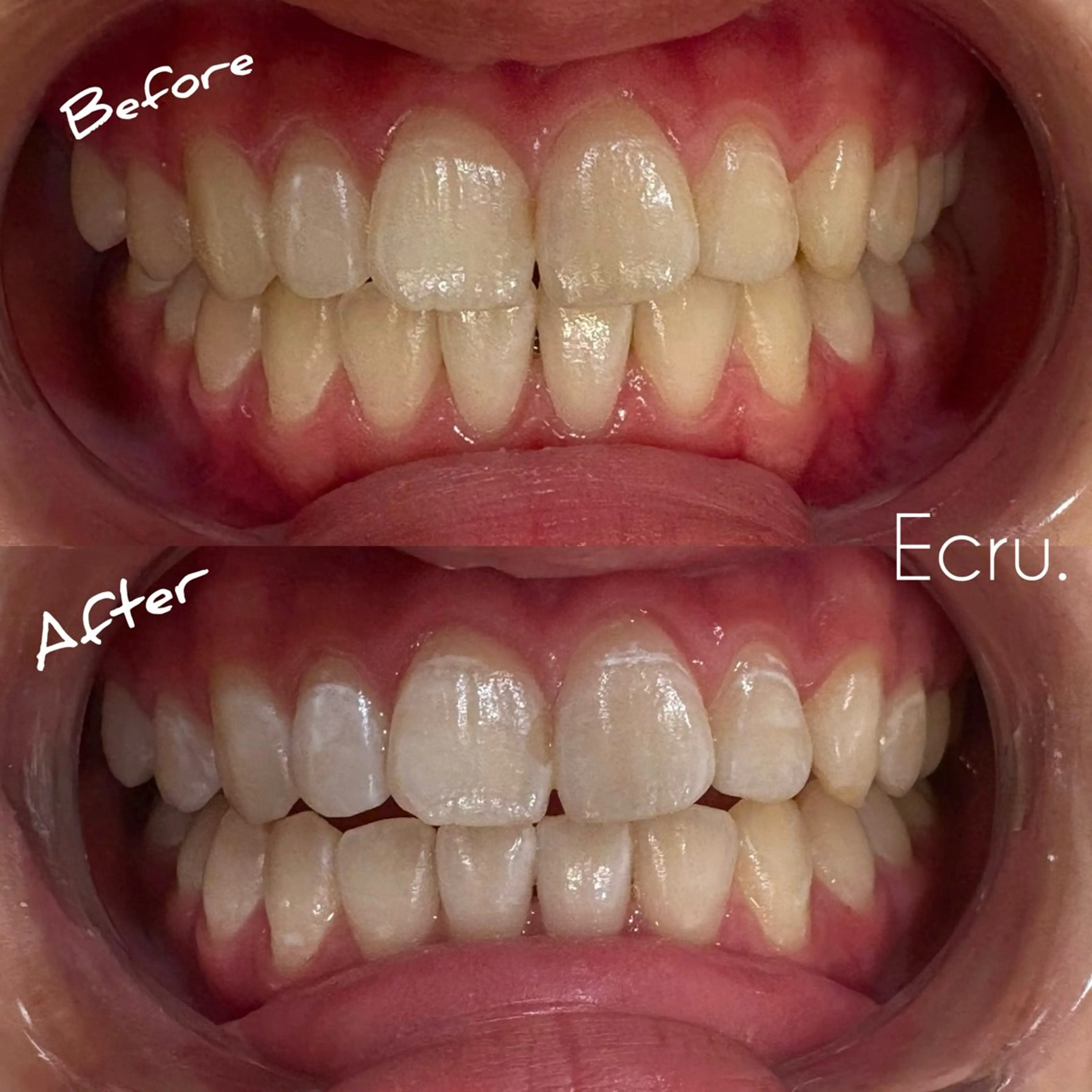 キッズ エステ ホワイトニングサロン Ecru所属・ホワイトニングサロン Ecru エクリュのその他イメージ