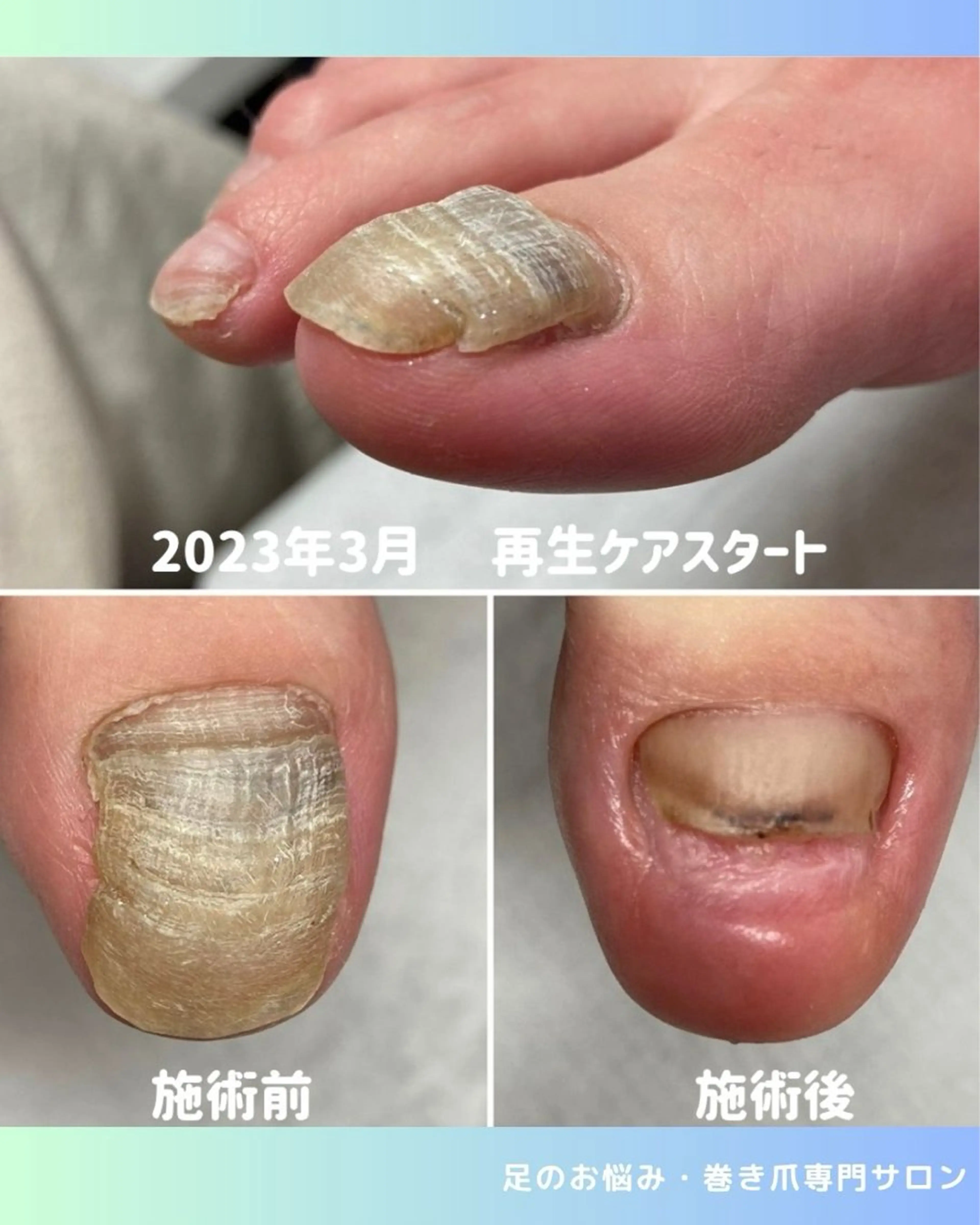 ネイル フットネイル rangrang nailのネイルデザイン