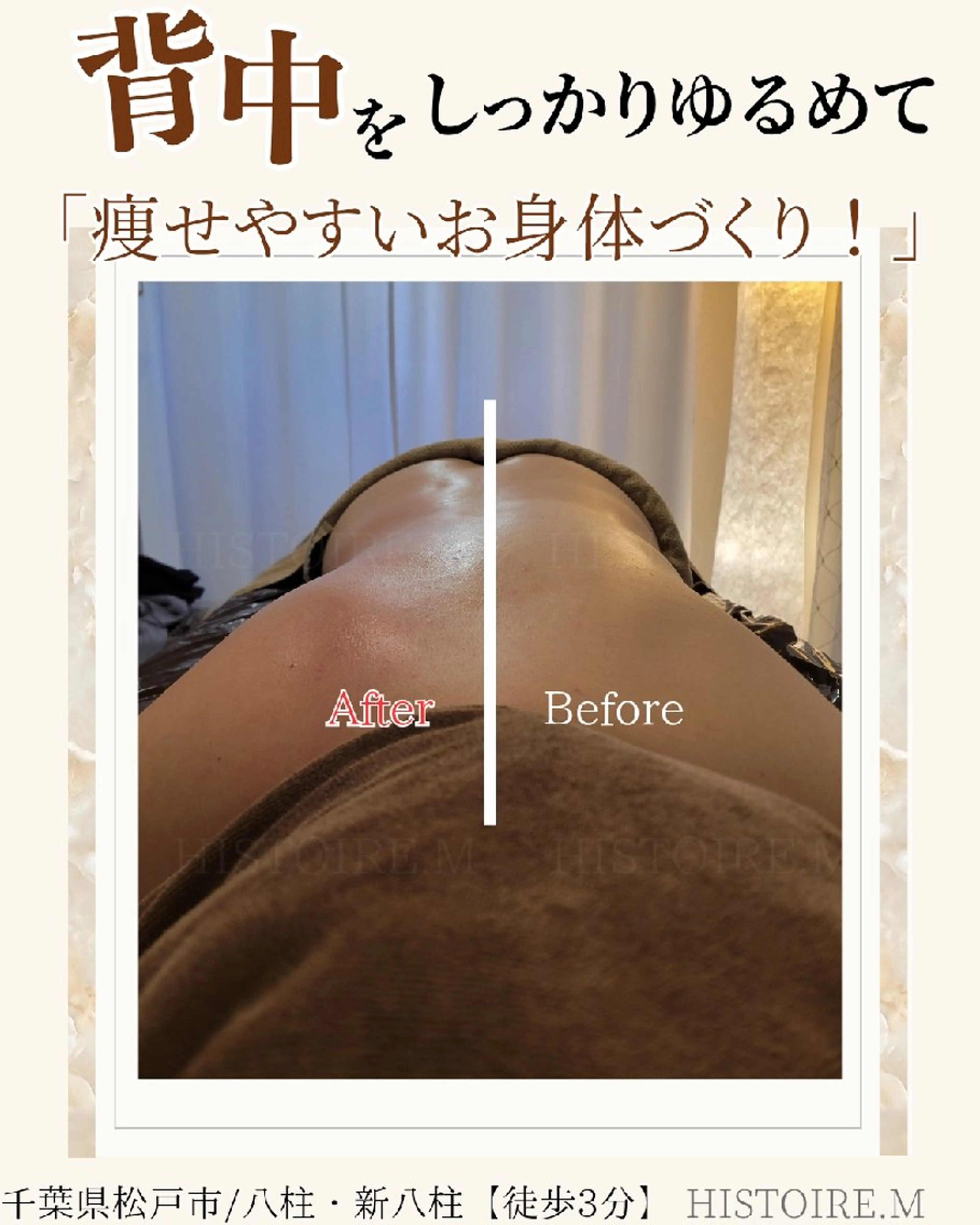 エステ リラク HISTOIRE.M イストアールエム所属・ダイエット/体質改善 /筋膜リリース専門店のエステ・リラクイメージ