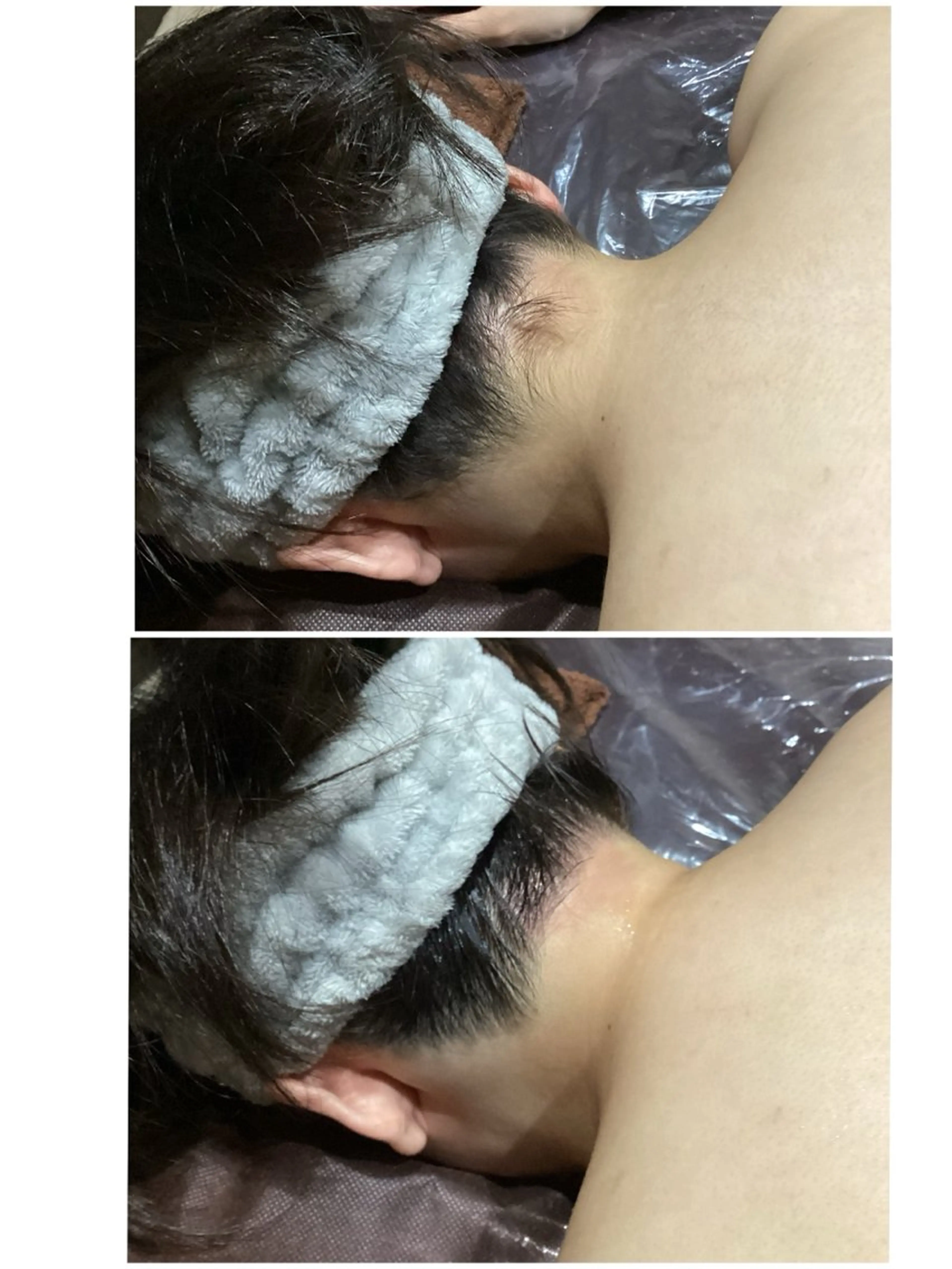 脱毛 Ange -viva la vida-所属・Esthesalon -Ange-のエステ・リラクイメージ