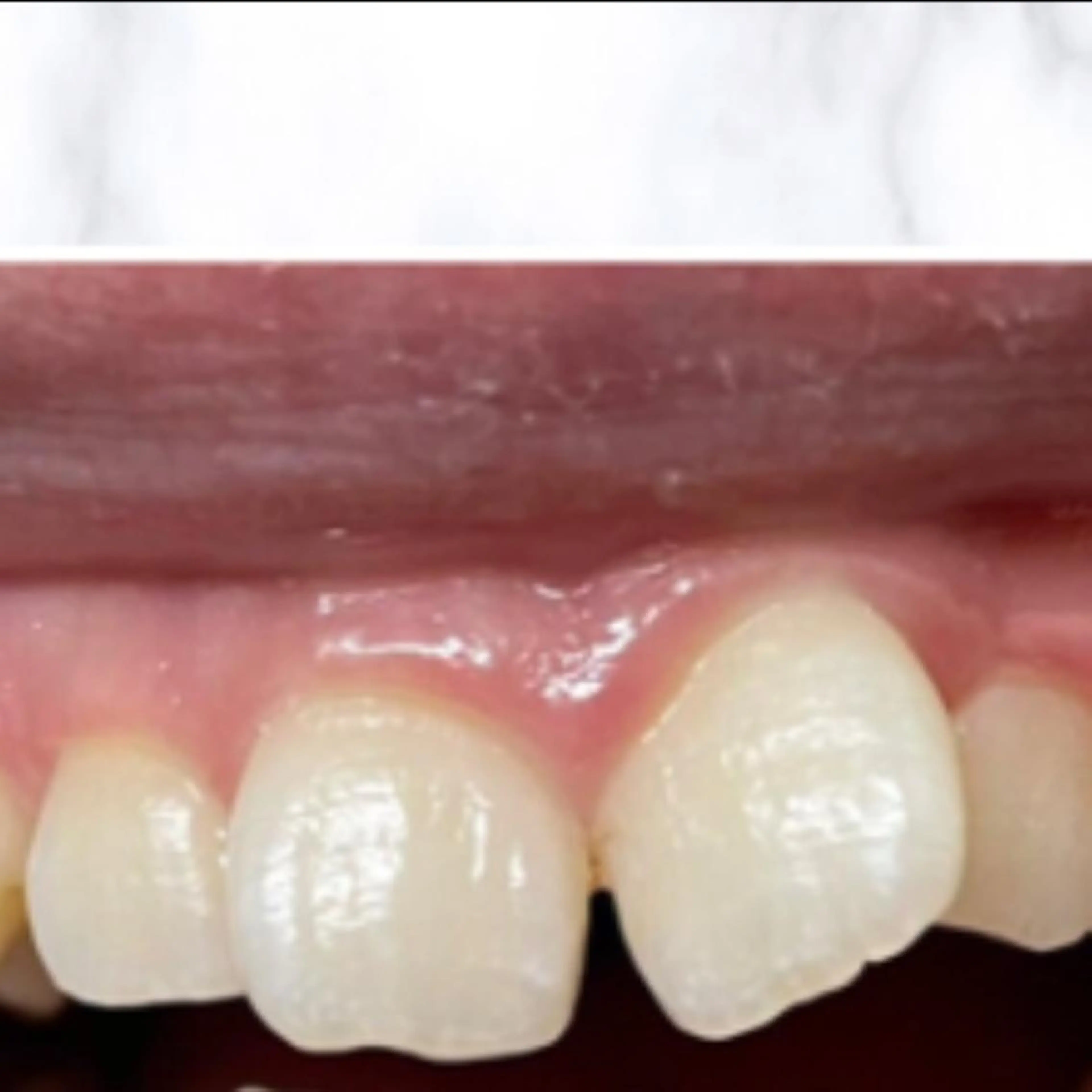 その他 ライトケアサロン 渋谷店② 渡邊のその他イメージ