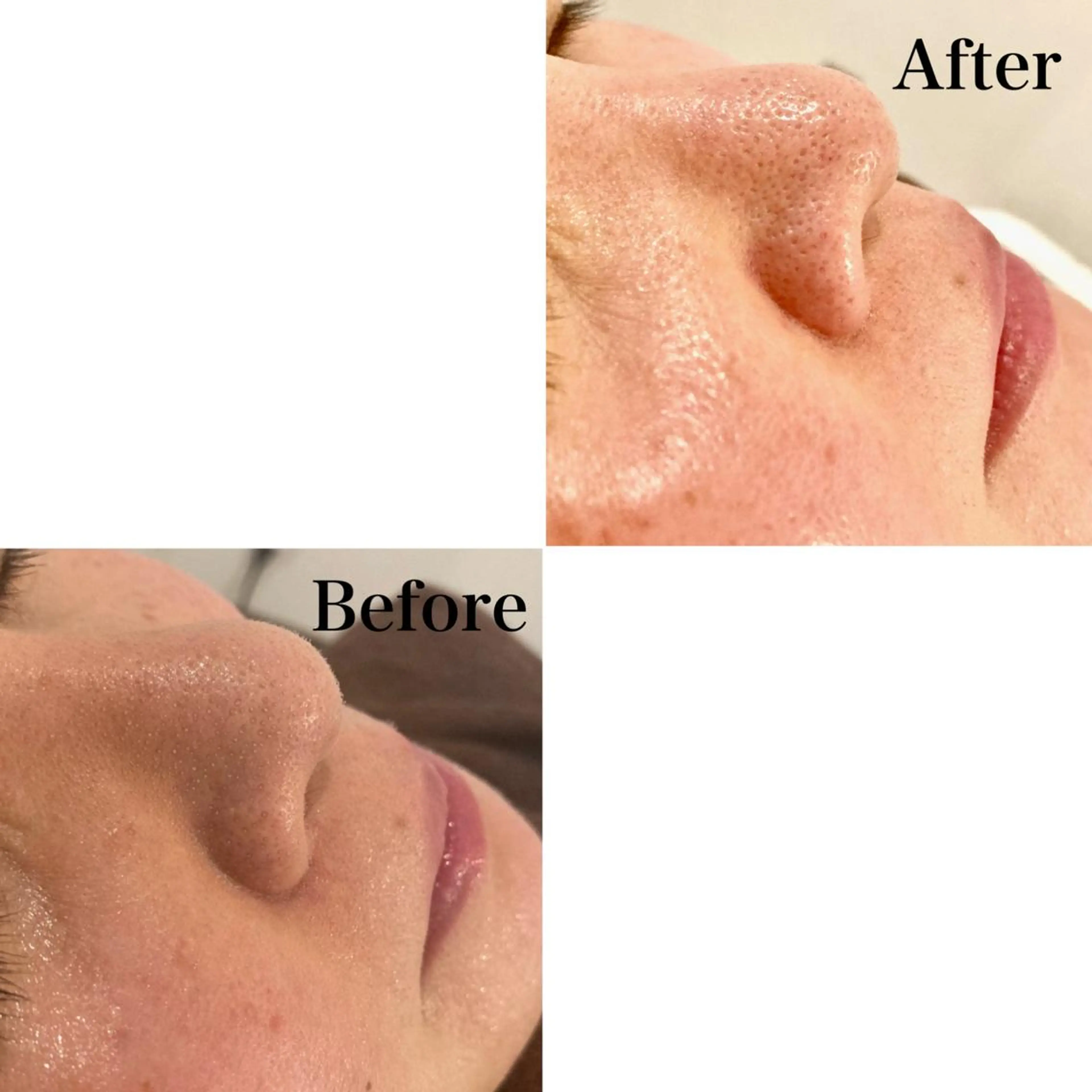 Ｂ&H所属・頭痛•肩こり専門/ 眉サロンB&H心斎橋のエステ・リラクイメージ