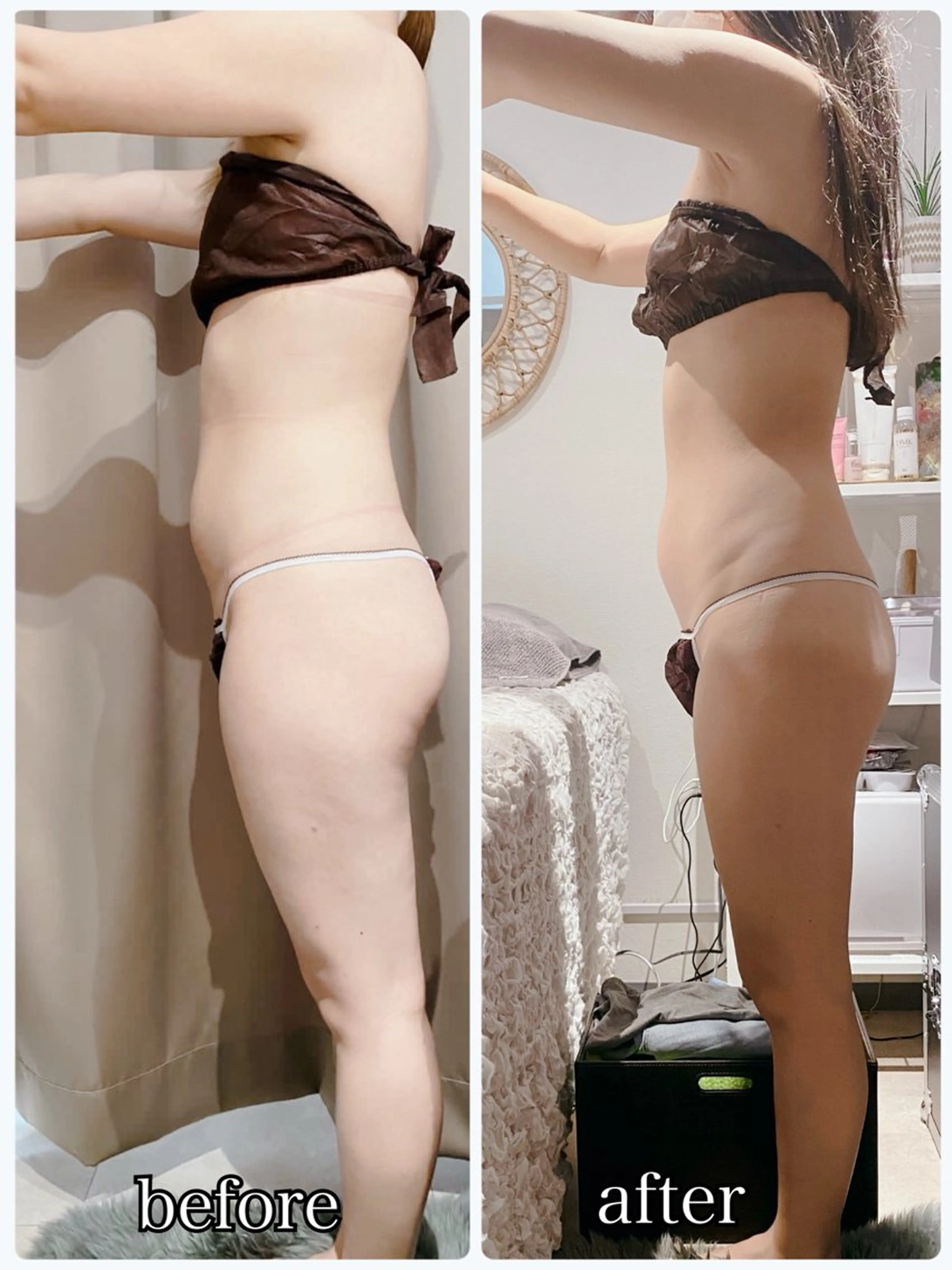 エステ リラク 【痩身・脱毛サロン】 REBISKIN🌱のエステ・リラクイメージ