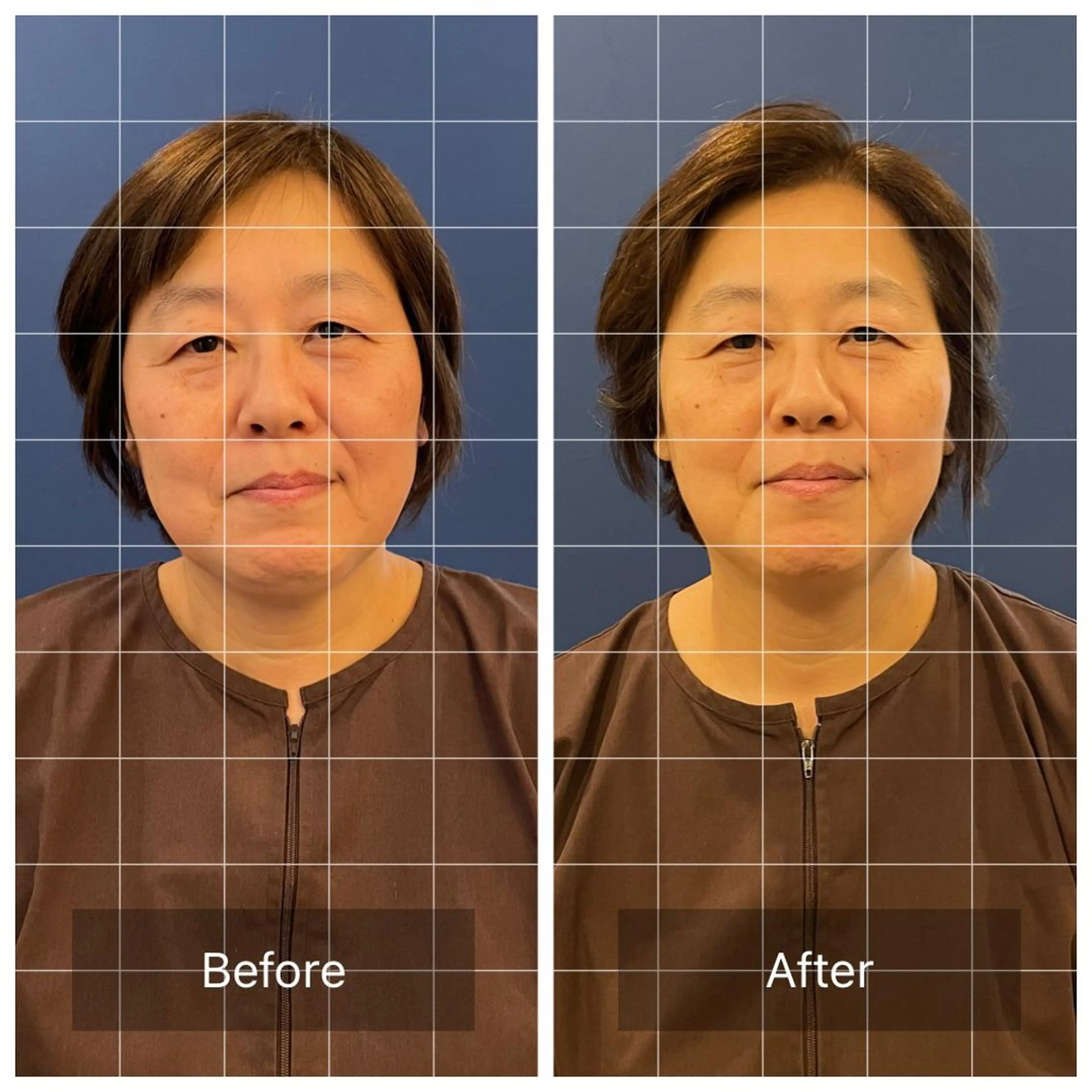 美容鍼　蒼月-aotsuki-所属・美容鍼「蒼月」 -アオツキ-のエステ・リラクイメージ