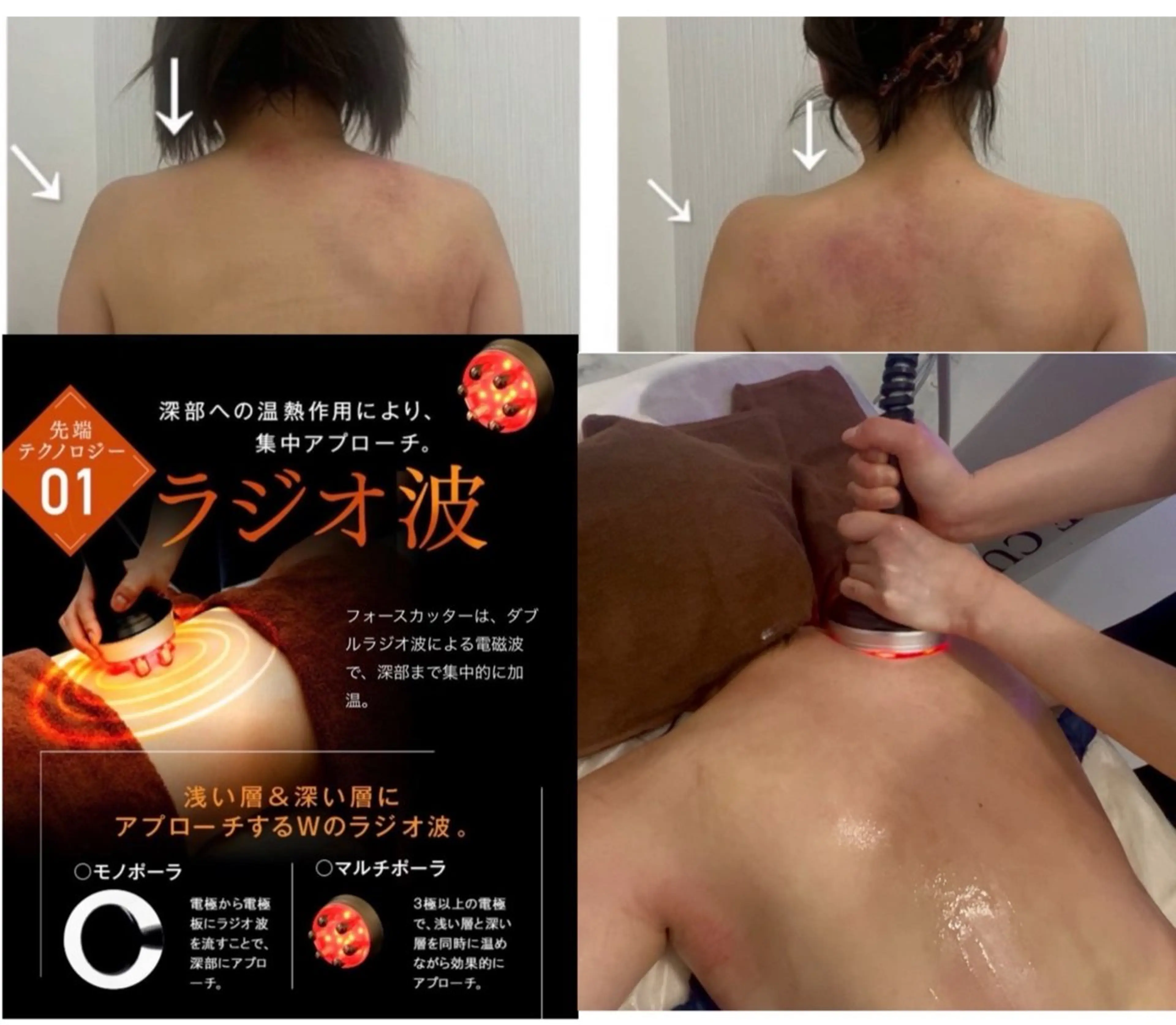 ブライダル痩身×脱毛 尼崎駅前サロンのエステ・リラクイメージ