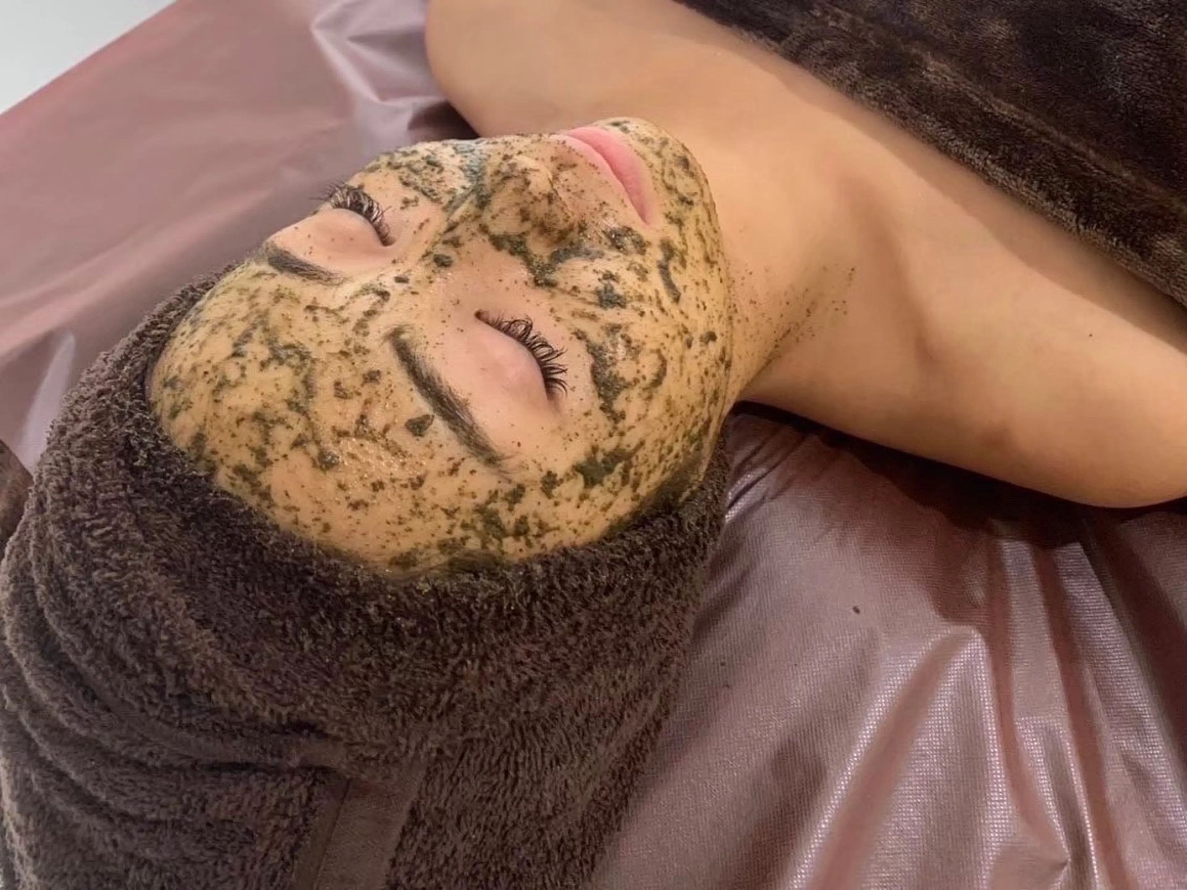 【ミニモ限定‼️】肌改善 🌿REVIハーブピーリング🌿ダウンタイムなし ✨【メンズ歓迎】の写真