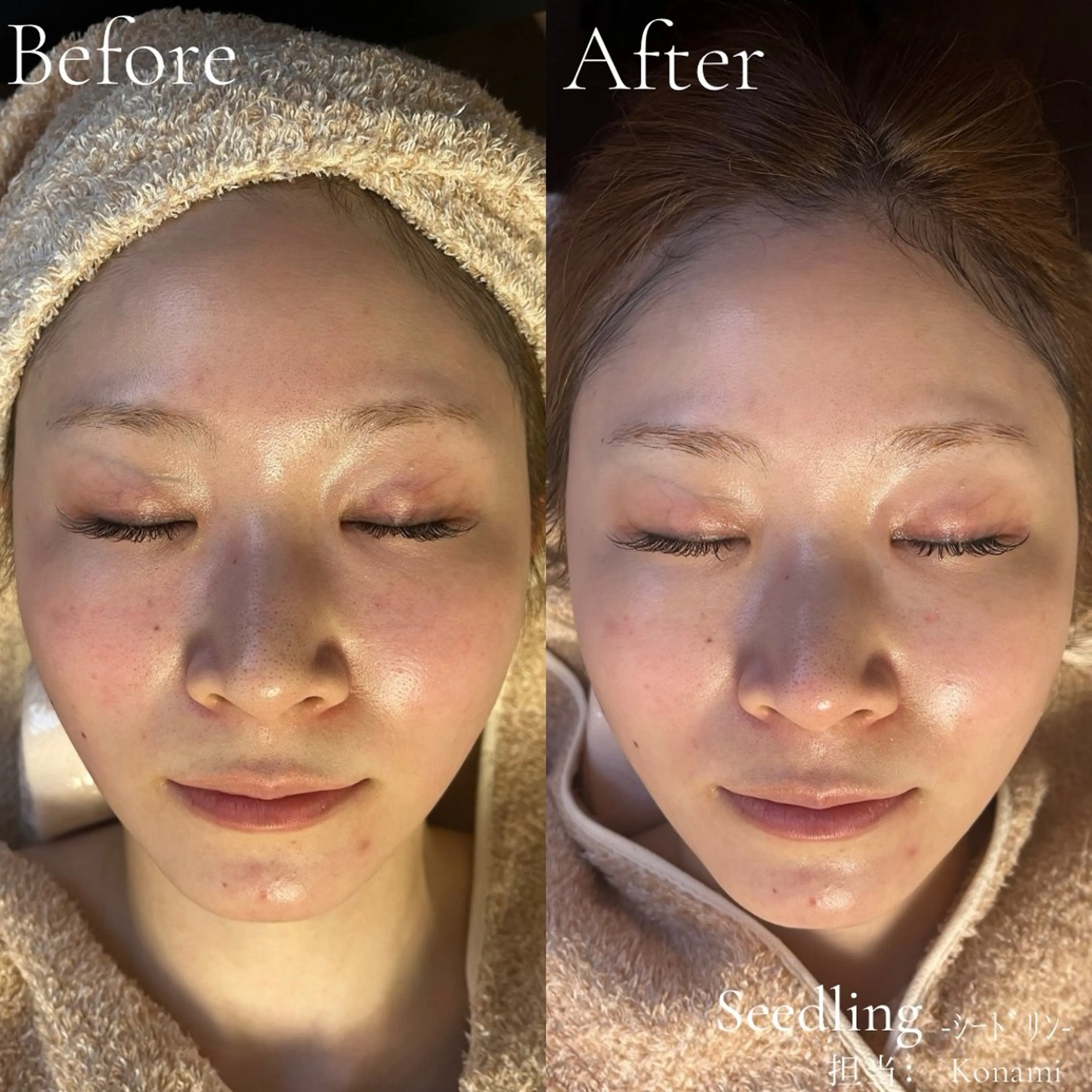 エステ シードリン 府内店 小波のエステ・リラクイメージ