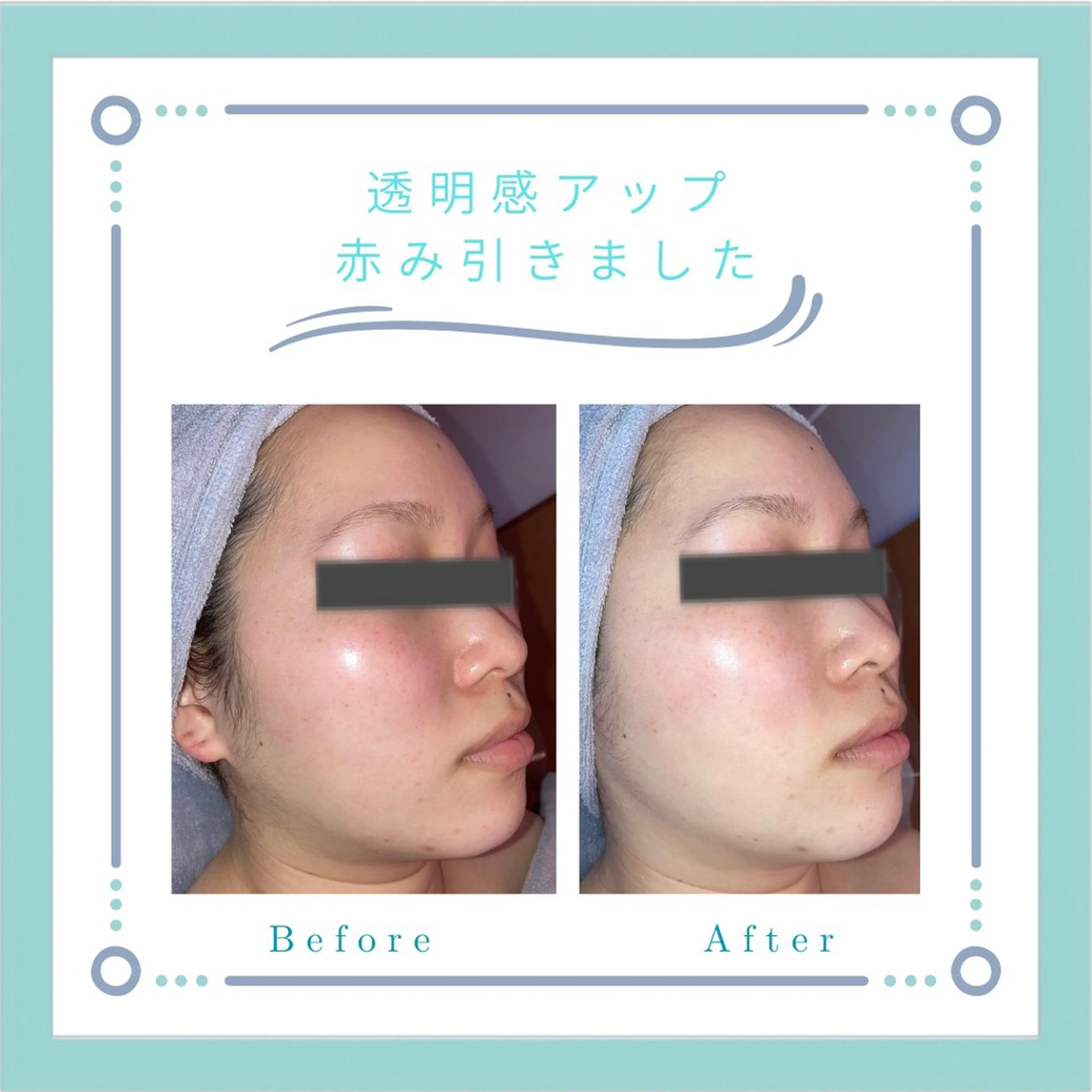 フェイシャルエステLe・Ciel所属・Le・Ciel フェイシャル&ボディのエステ・リラクイメージ