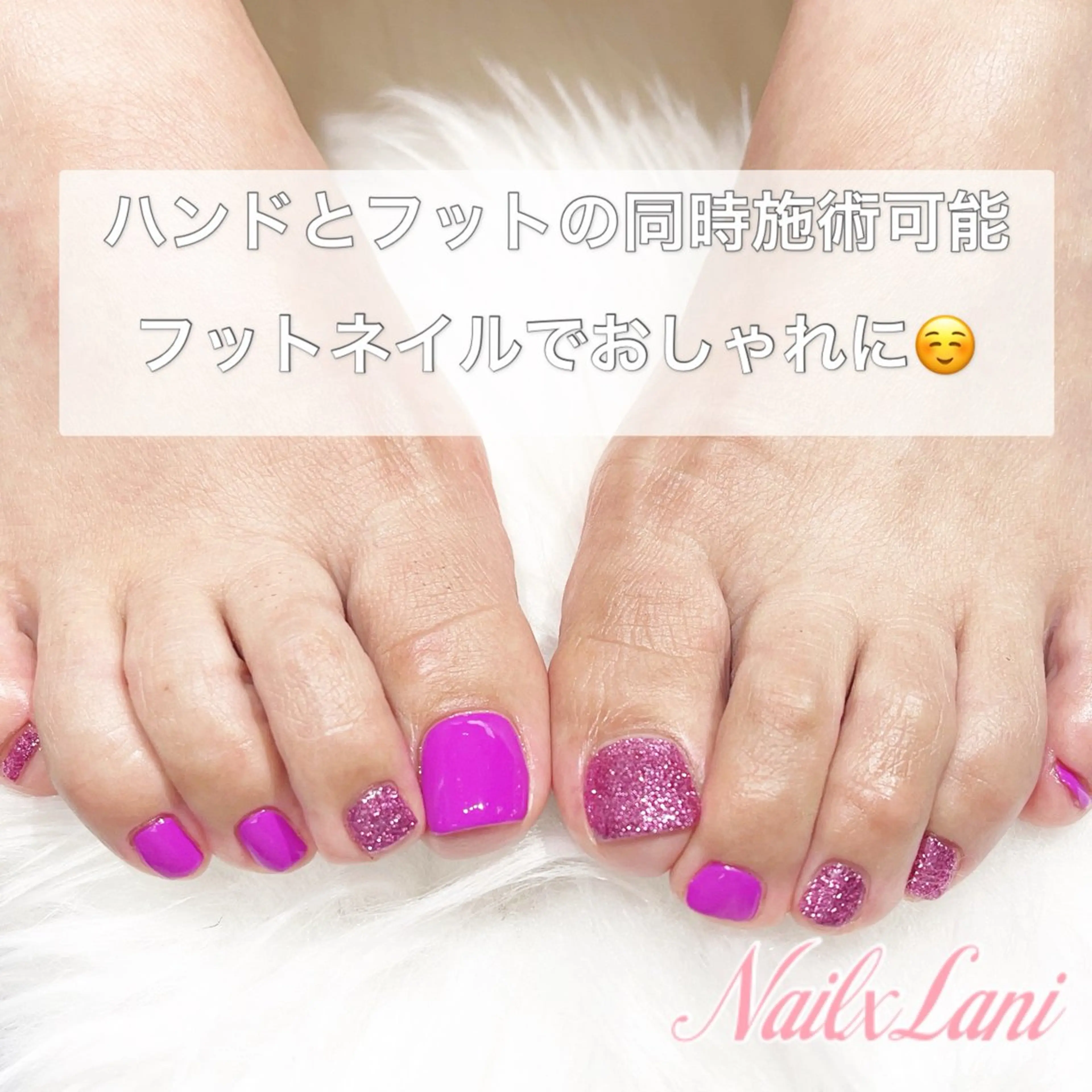 ネイル フットネイル 練馬駅近ネイルラニ 不細工爪90分で美爪のネイルデザイン
