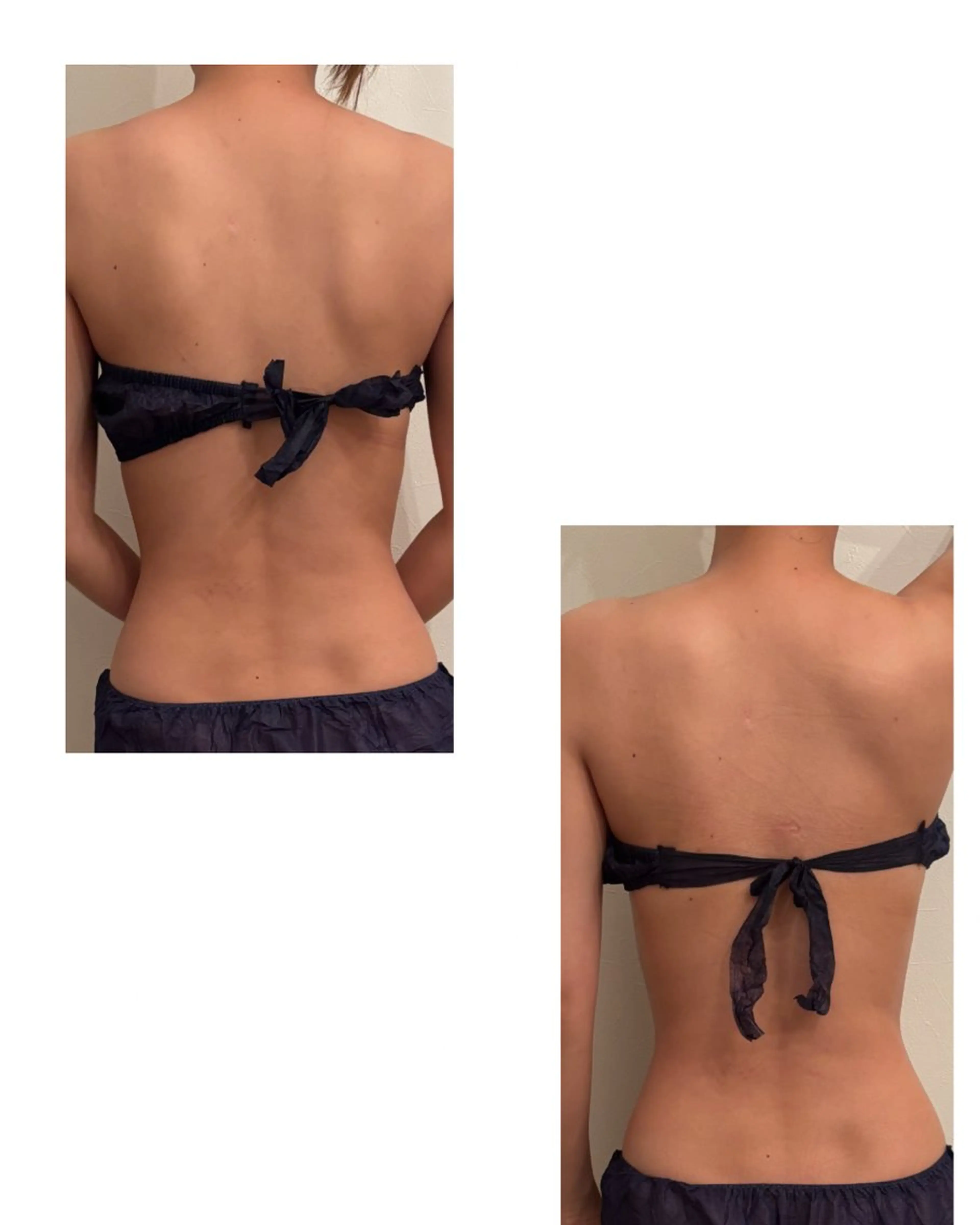 浮腫み，冷え性、 体質改善、のエステ・リラクイメージ