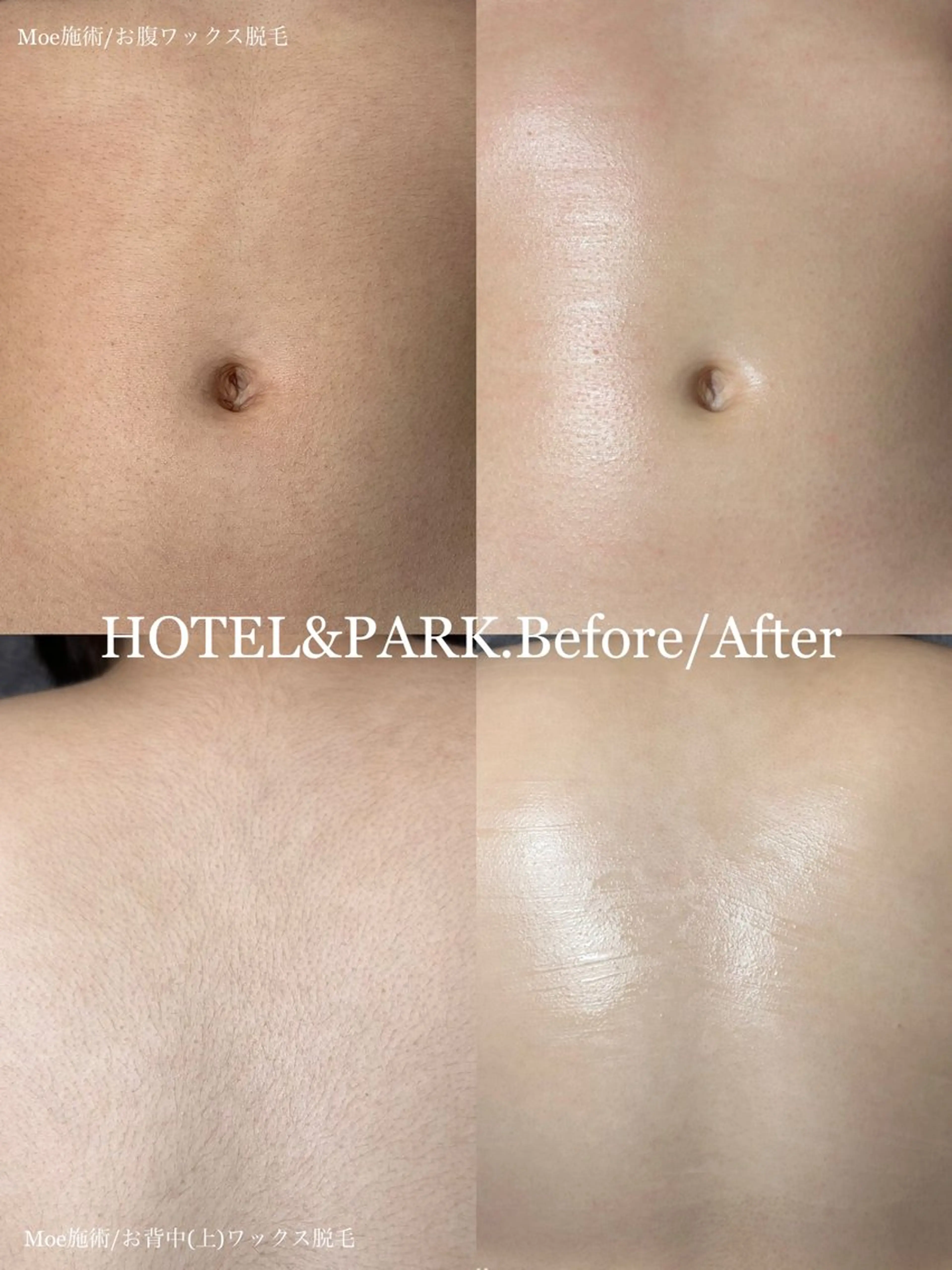 HOTEL&PARK . ワックス脱毛のエステ・リラクイメージ