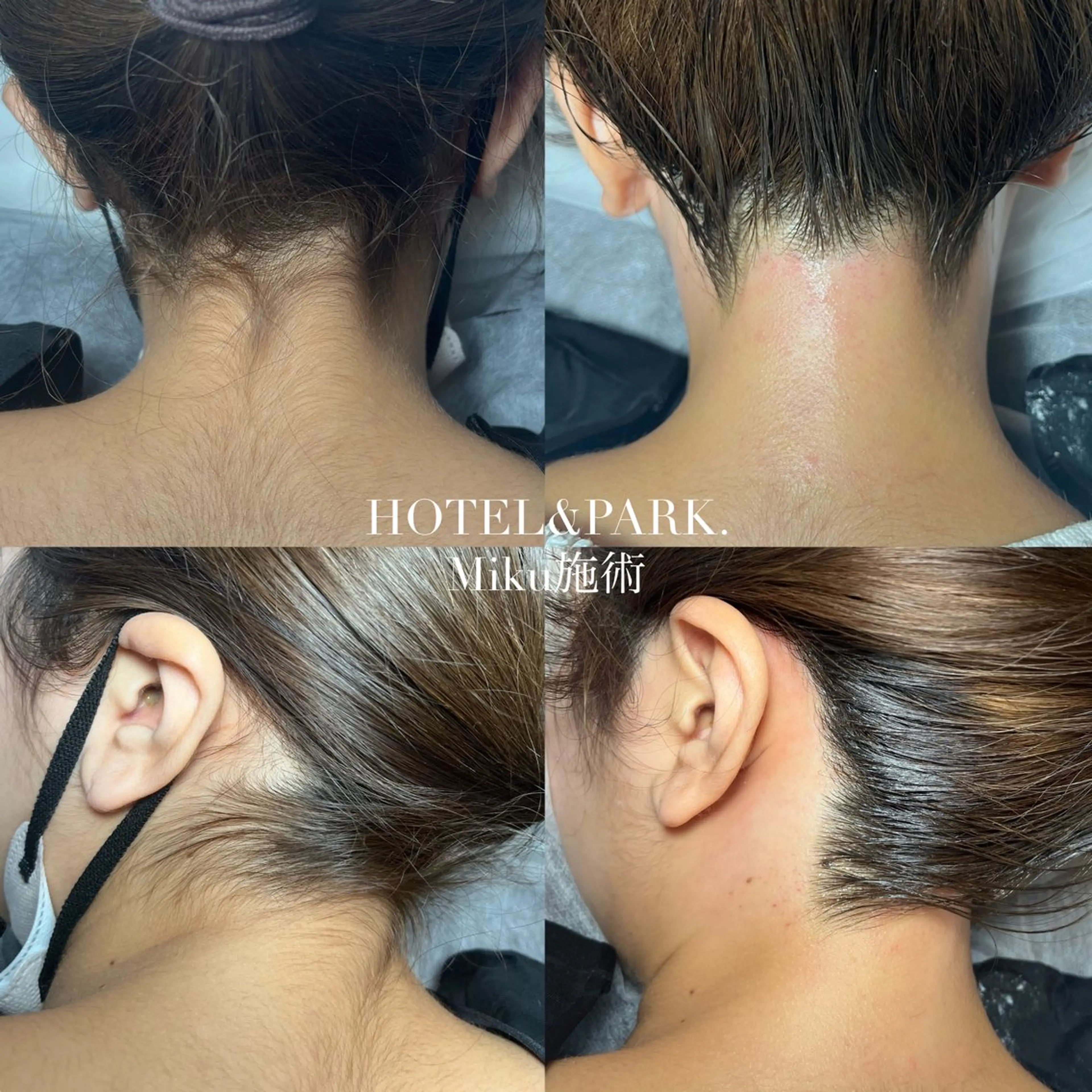 脱毛 HOTEL&PARK Mikuワックス脱毛のエステ・リラクイメージ