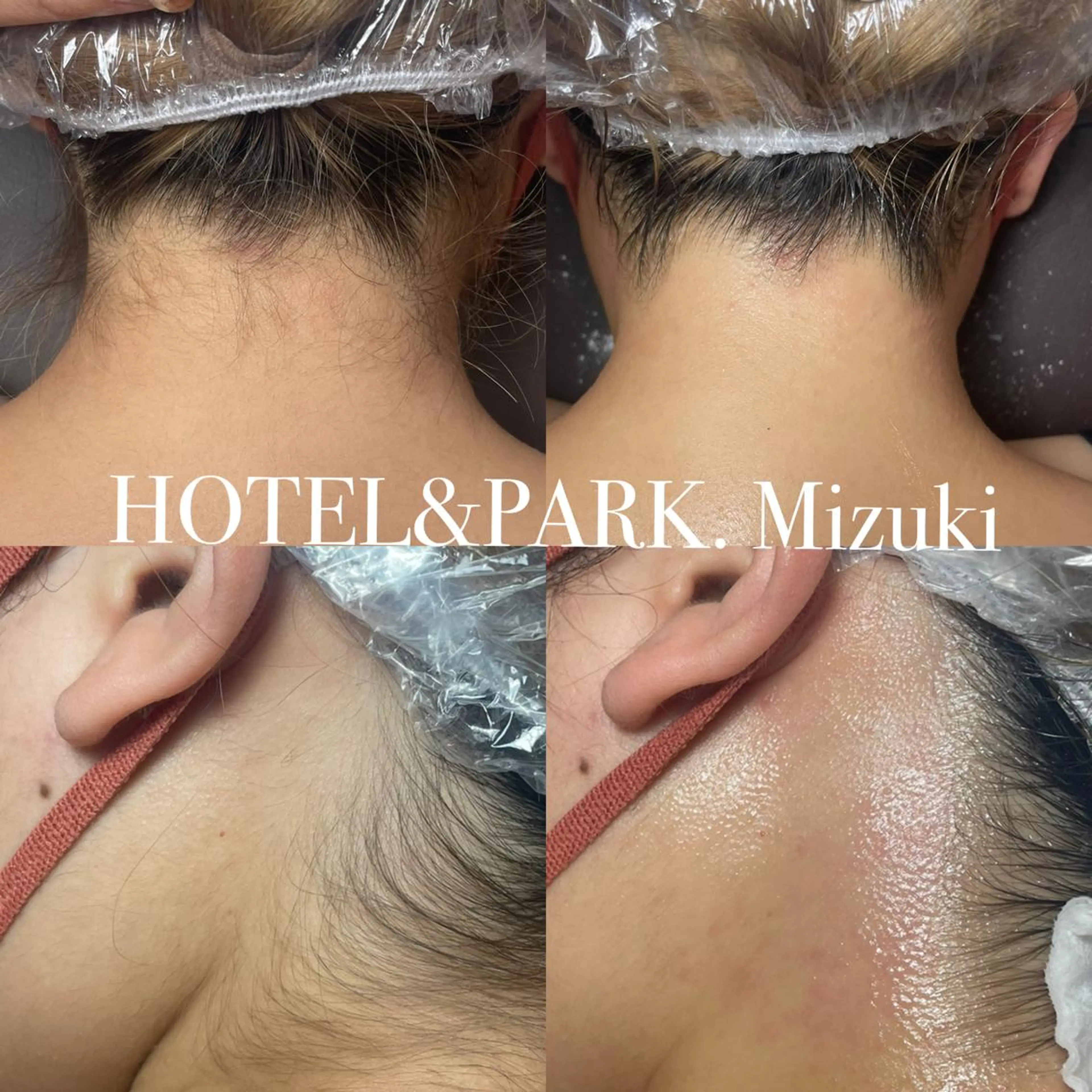 HOTEL&PARK . ワックス脱毛のエステ・リラクイメージ