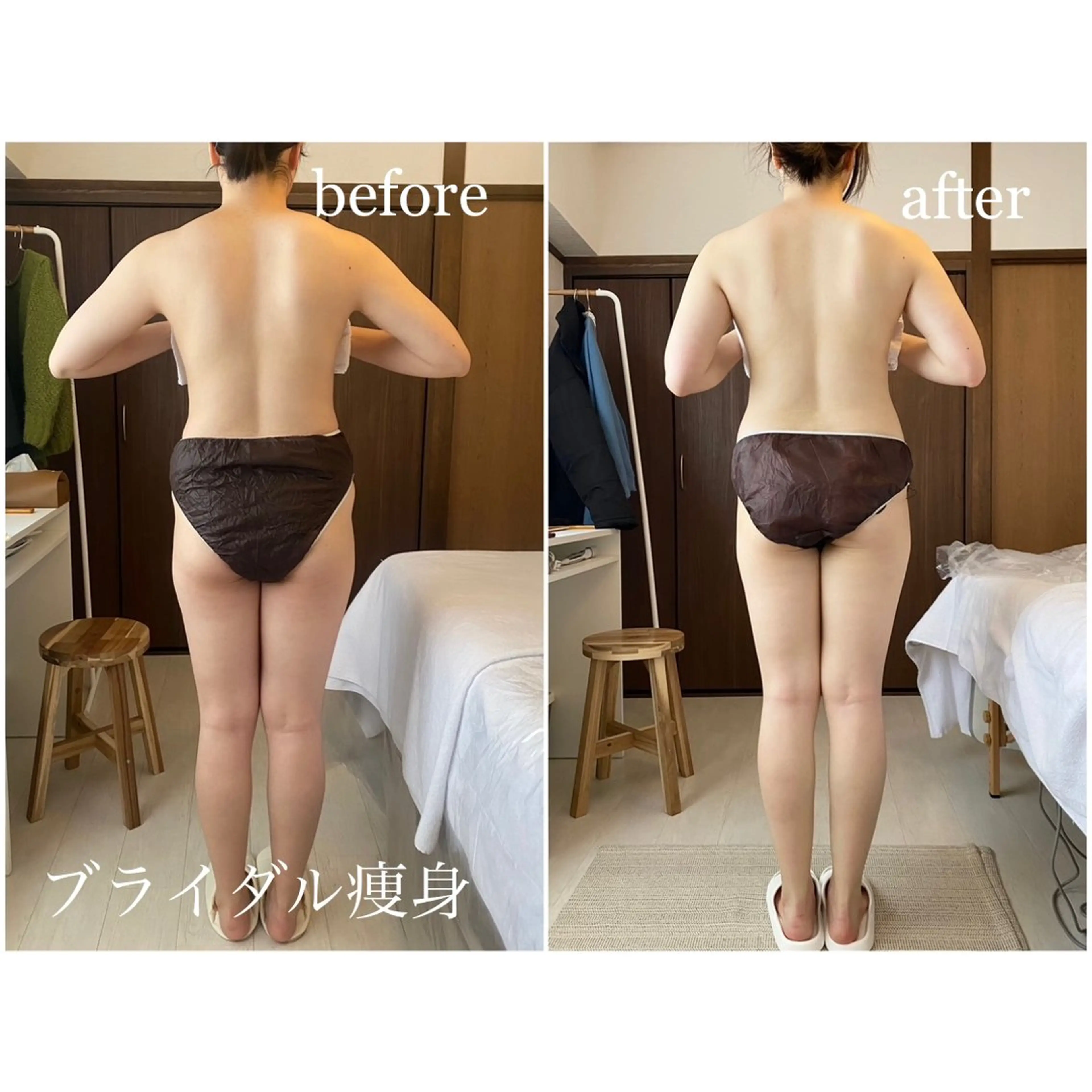 I'm -ｲﾑ-所属・肌質改善／ブライダル I'm.-イム-のエステ・リラクイメージ