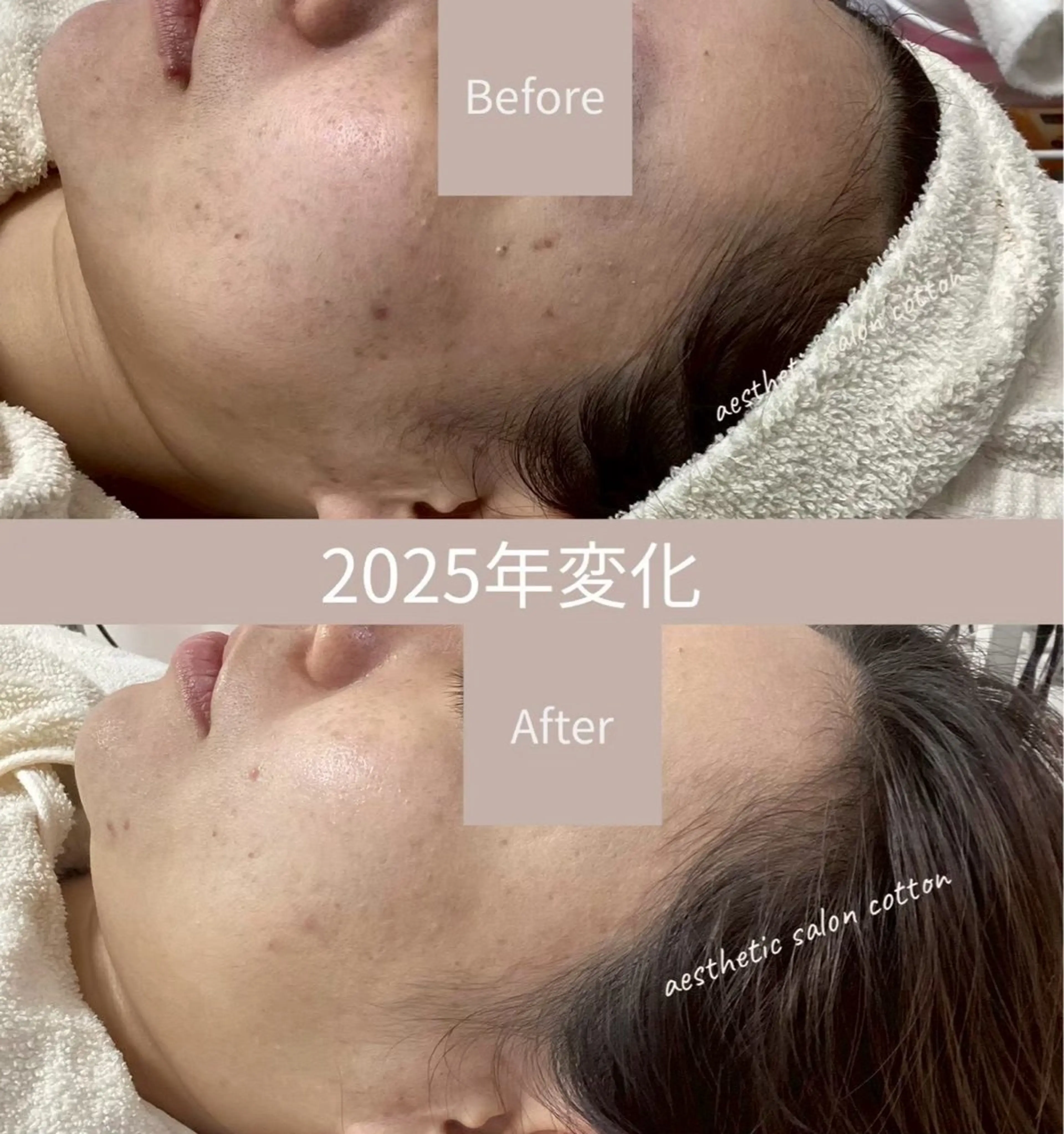 エステ 都度払い 肌質改善専門サロンのエステ・リラクイメージ