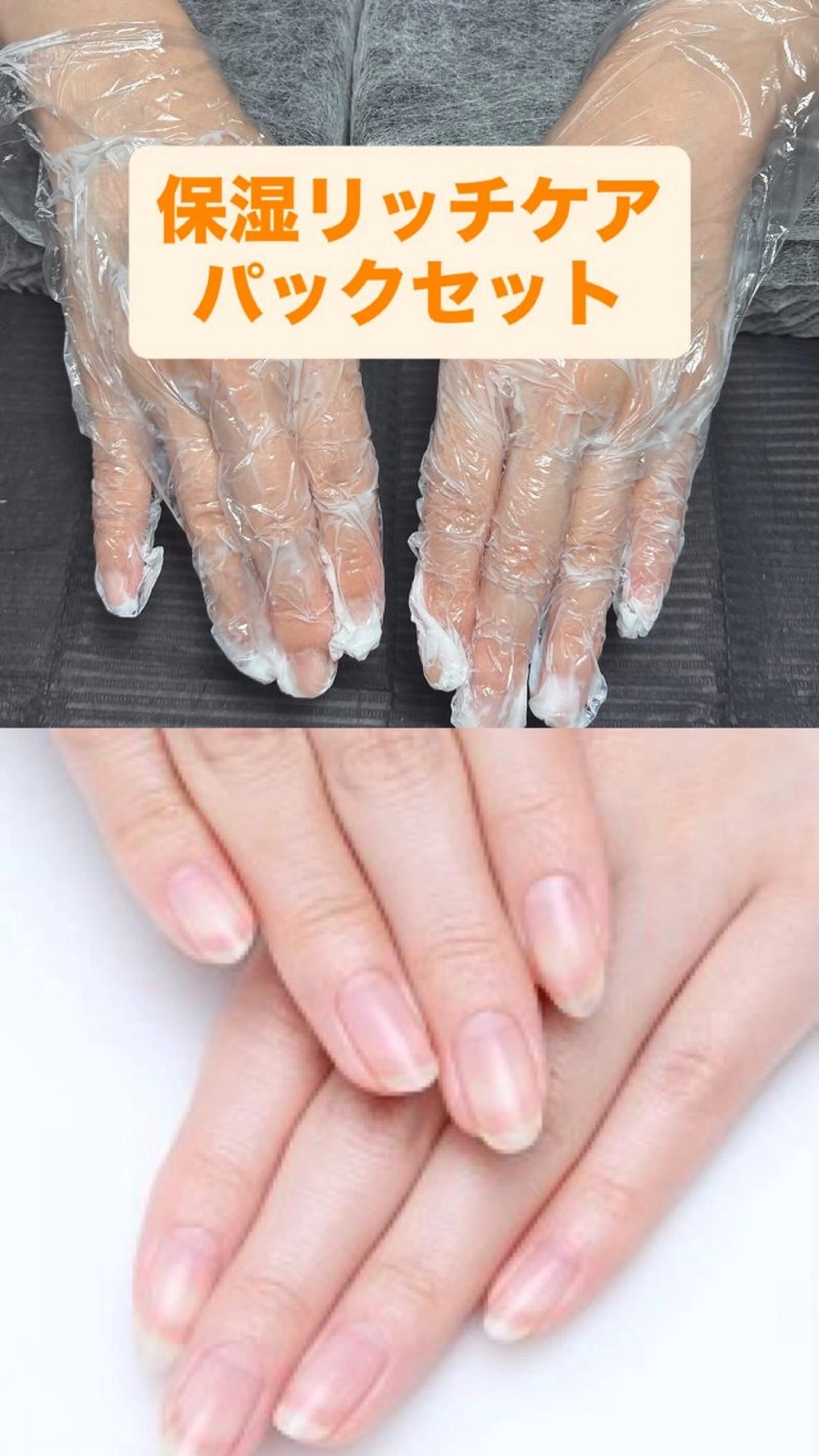 保湿パックケア（甘皮ケア）の写真