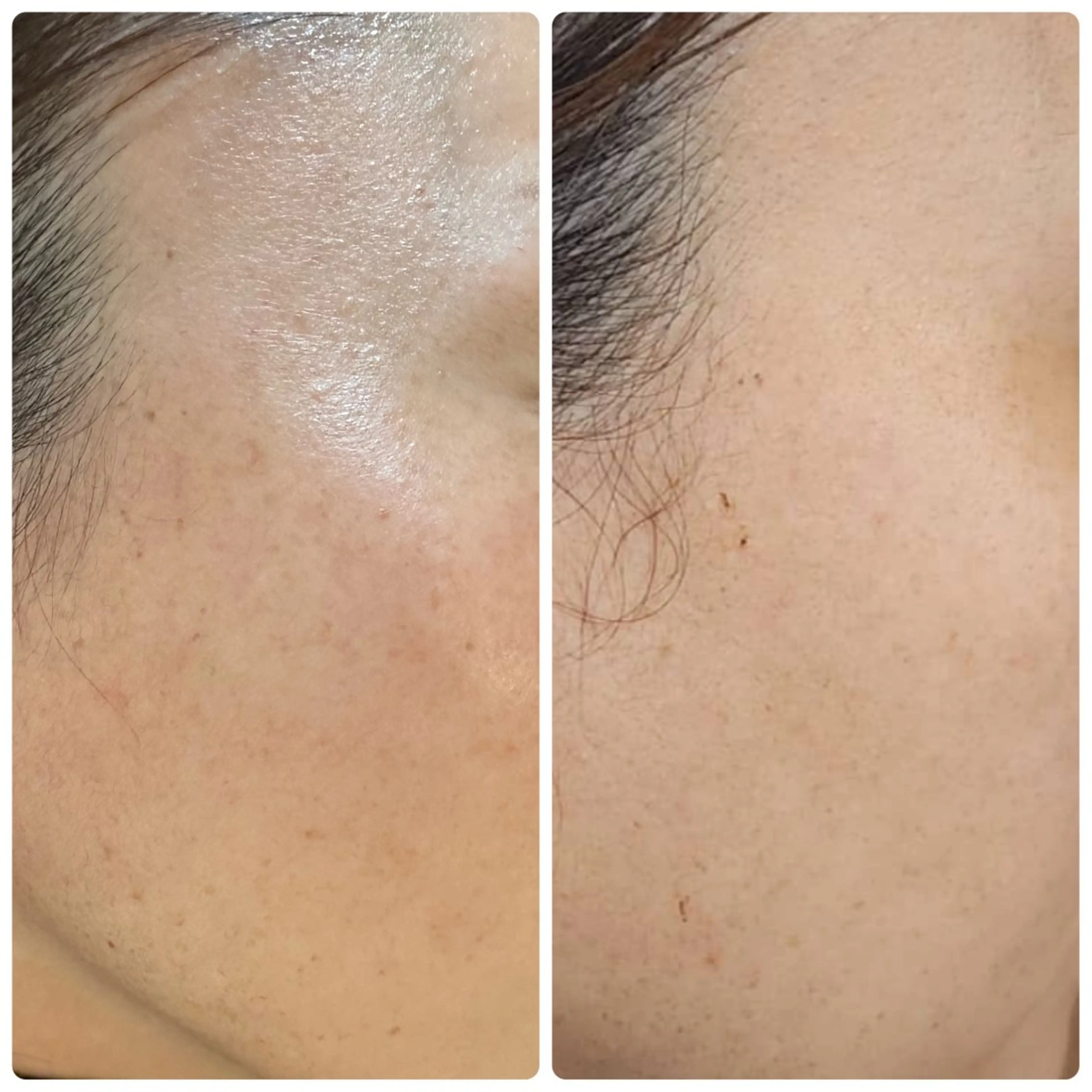 バストアップ専門/デ トックス/小顔コルギのエステ・リラクイメージ