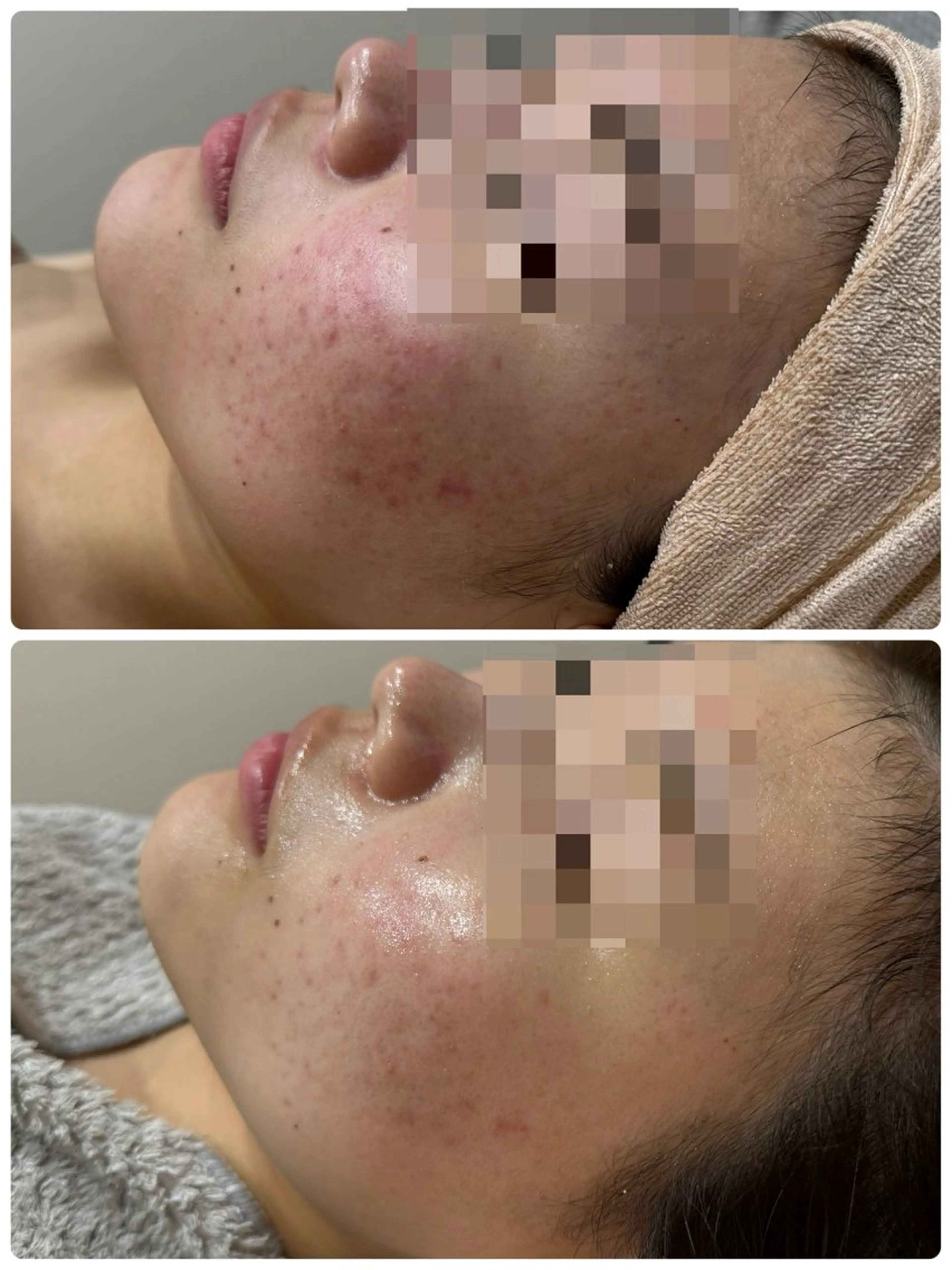 エステ 脱毛&フェイシャル 専門店muro.のエステ・リラクイメージ