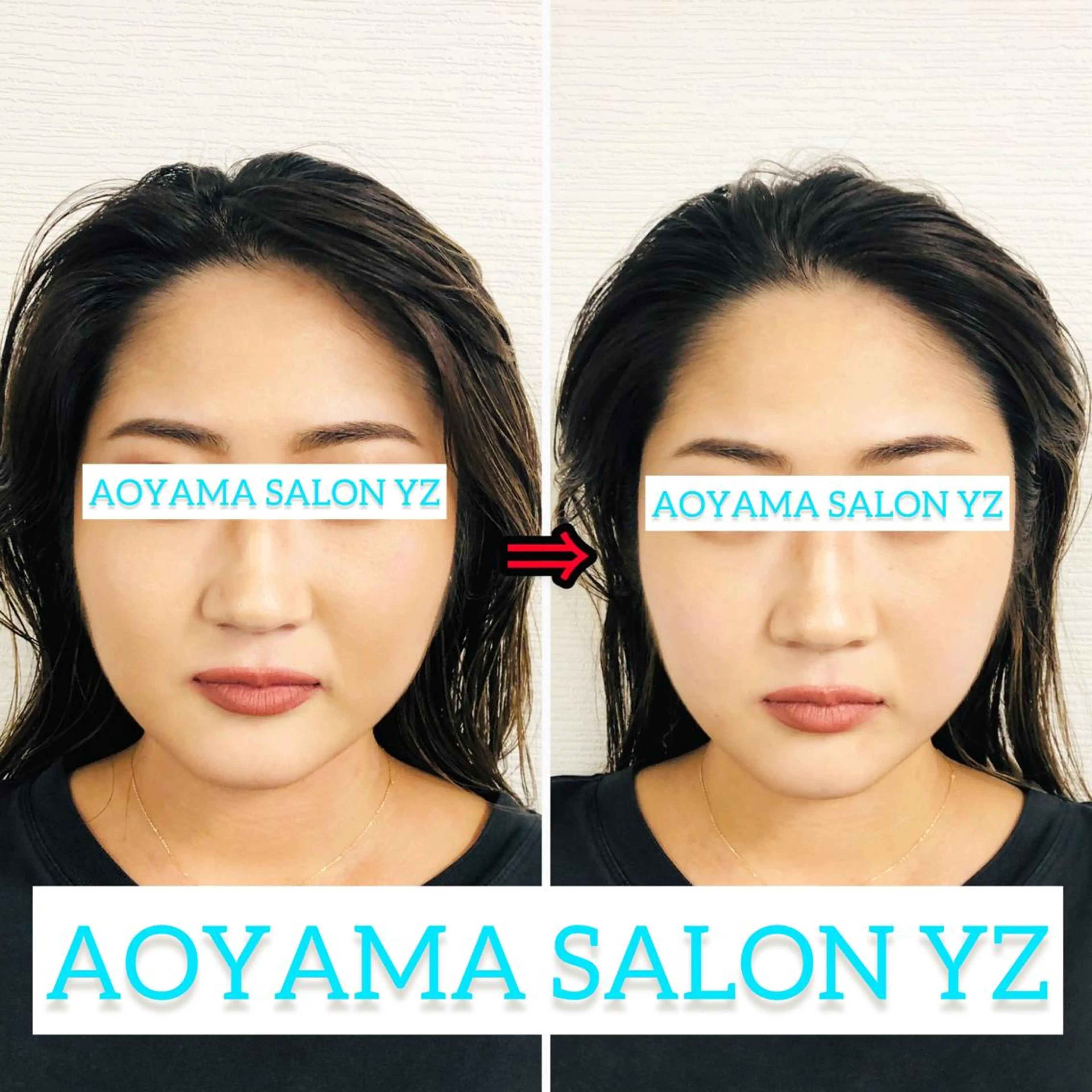 エステ リラク 小顔美容鍼専門サロン 渋谷YZのその他イメージ