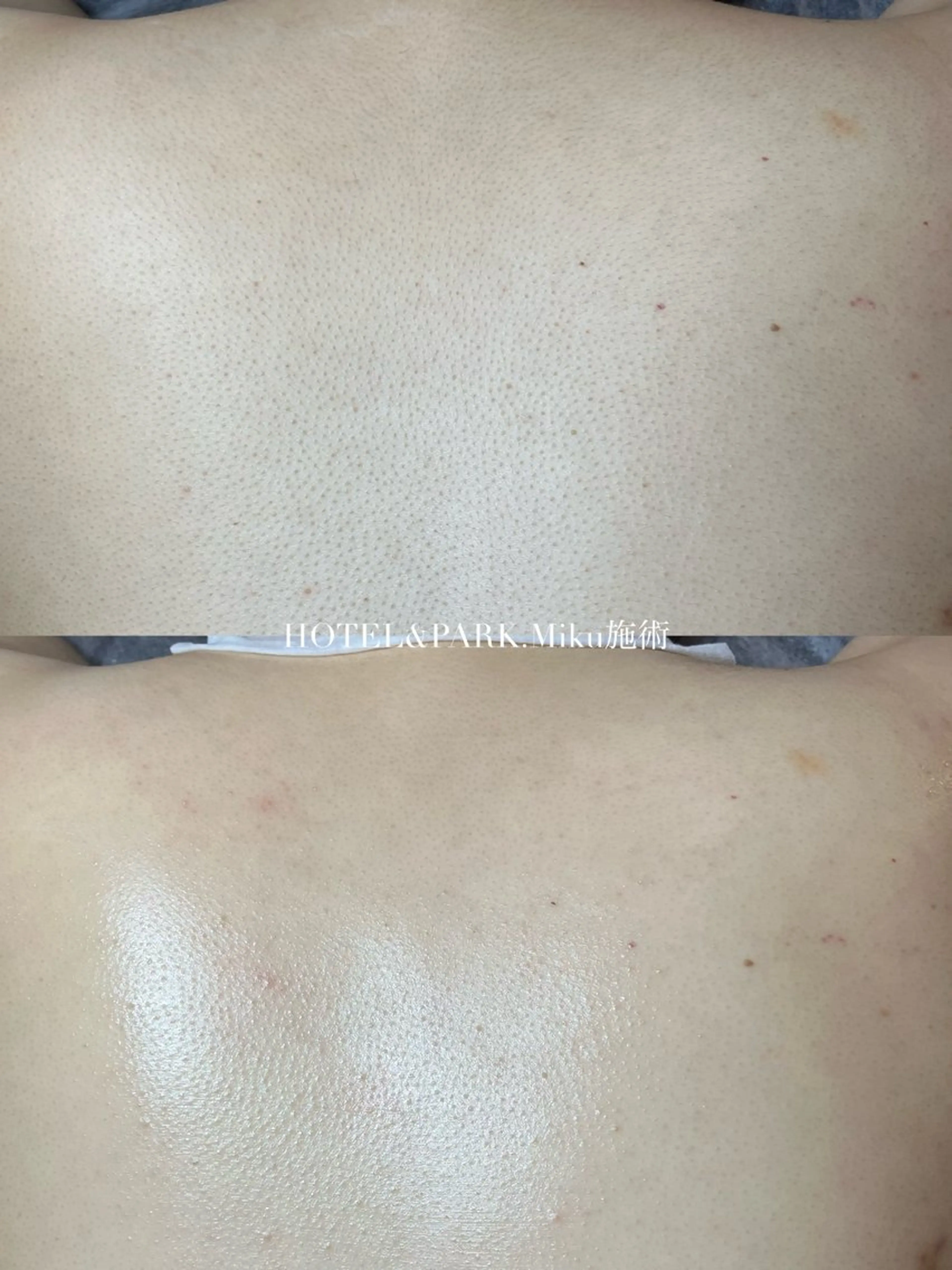 HOTEL&PARK Mikuワックス脱毛のエステ・リラクイメージ