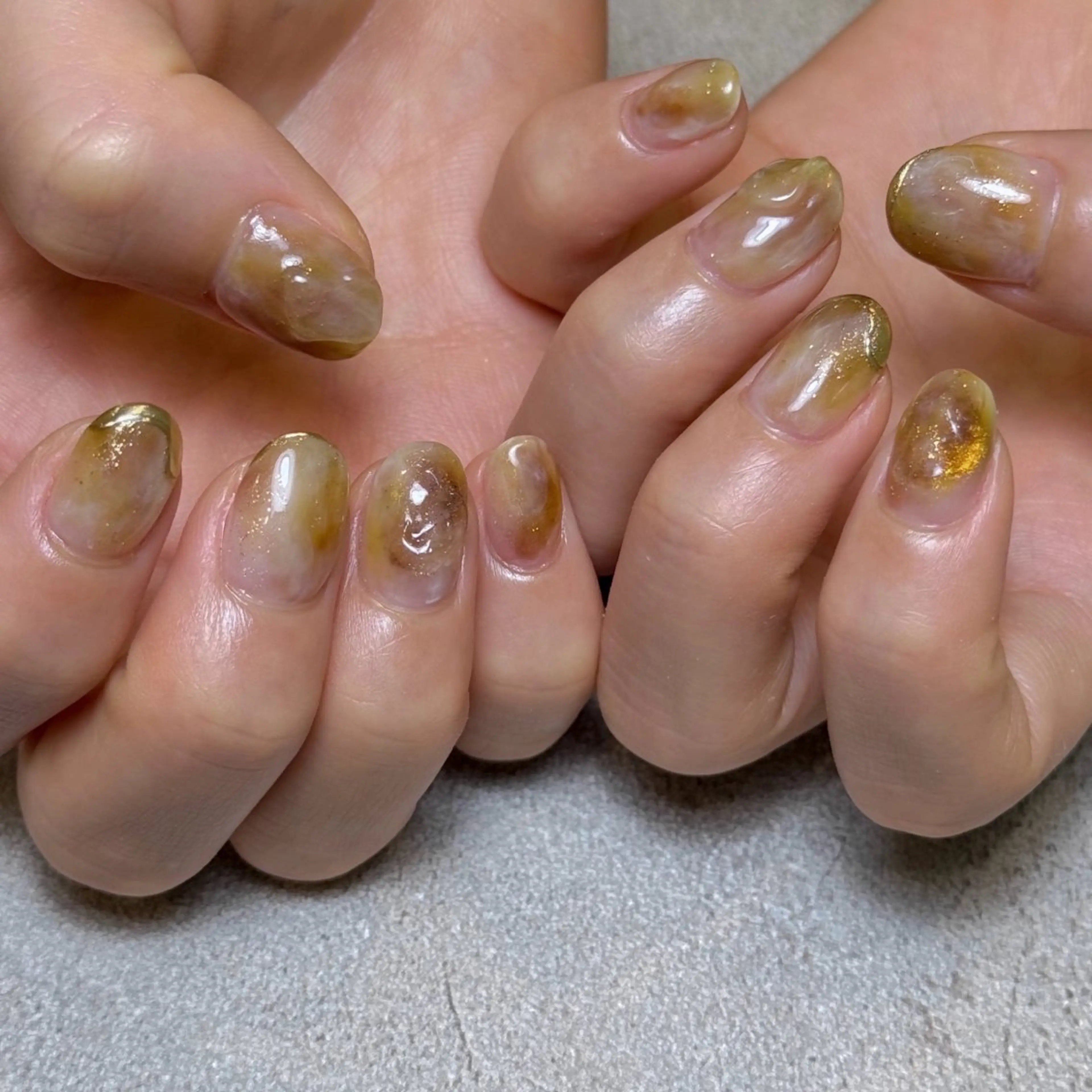 ネイル MAHINA nail所属・MAHINA/ネイル 巻き爪矯正/角質ケアのネイルデザイン