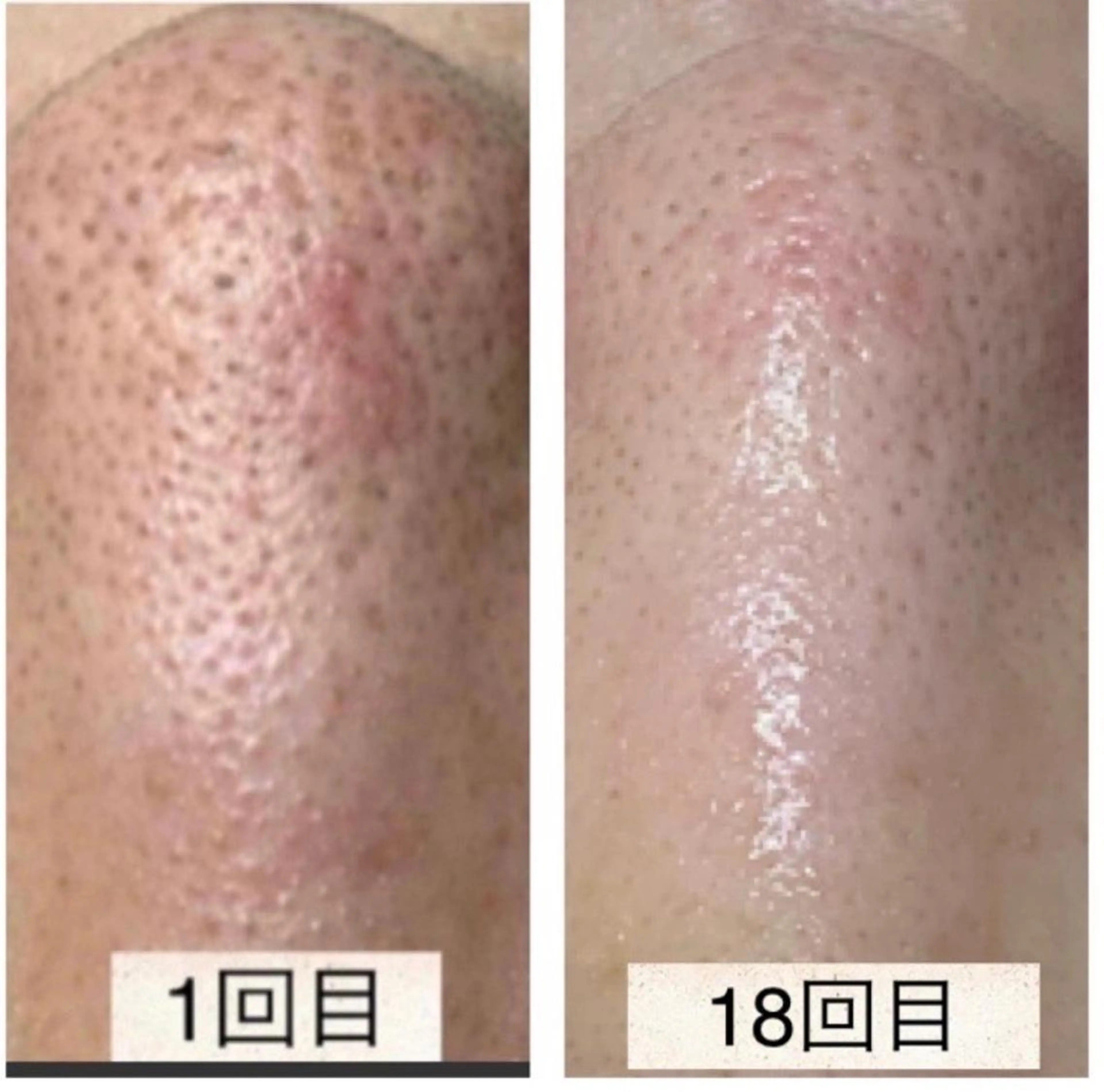 Eriedda所属・松下 千恵のネイルデザイン