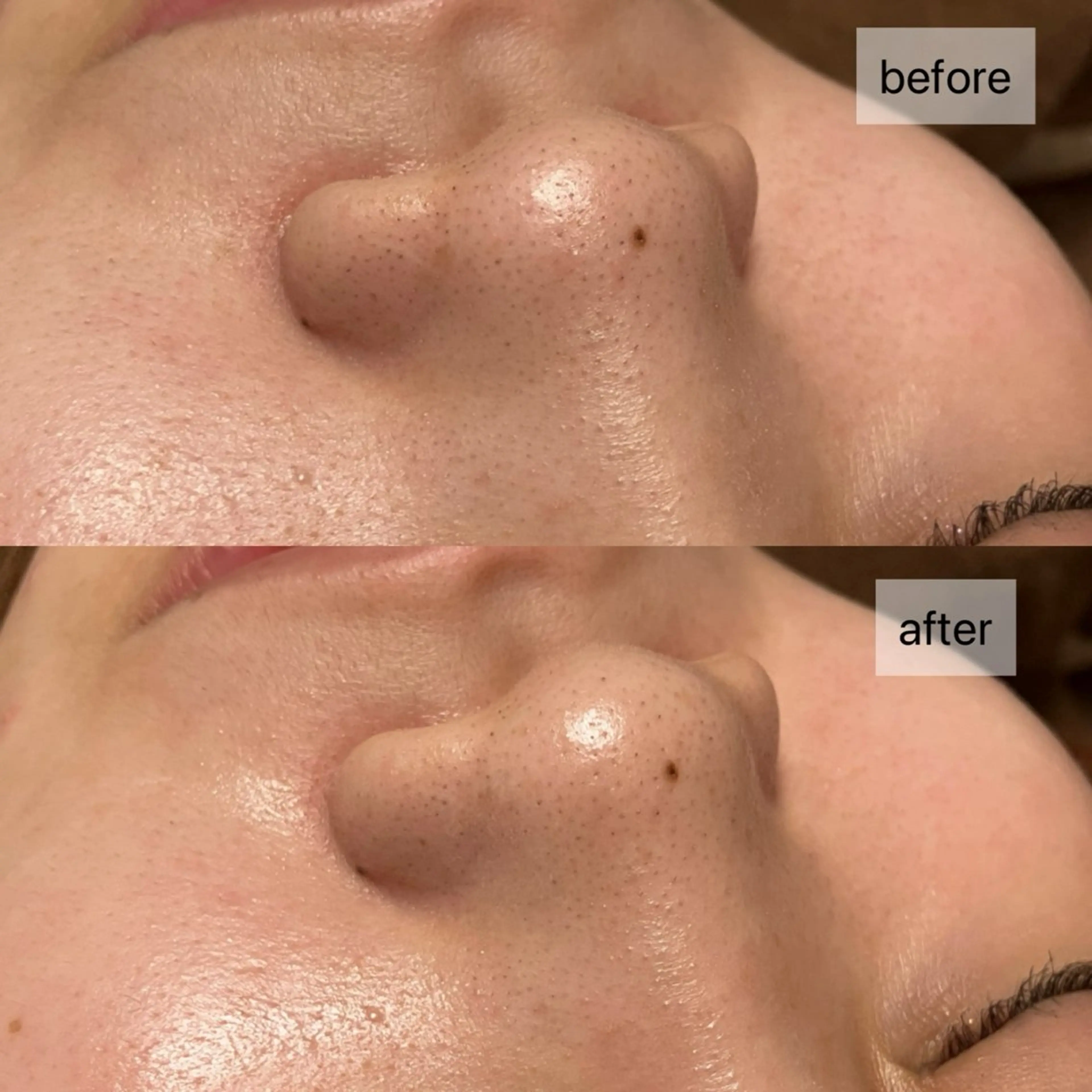 エステ HINANO矢場町店【ヒナノ】所属・脱毛/肌改善🌿 HINANO 村田のエステ・リラクイメージ