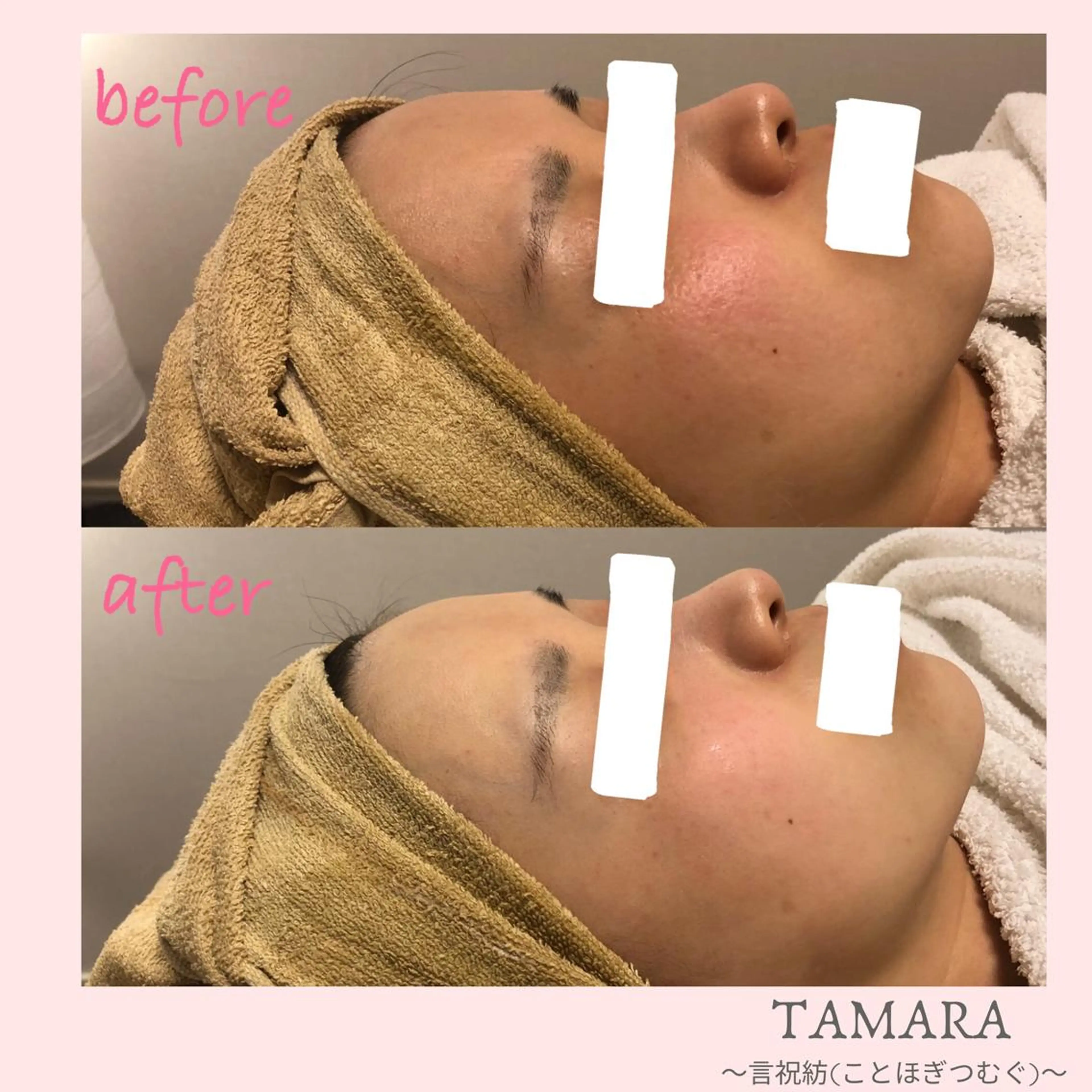 エステ リラク TAMARA 松下のエステ・リラクイメージ