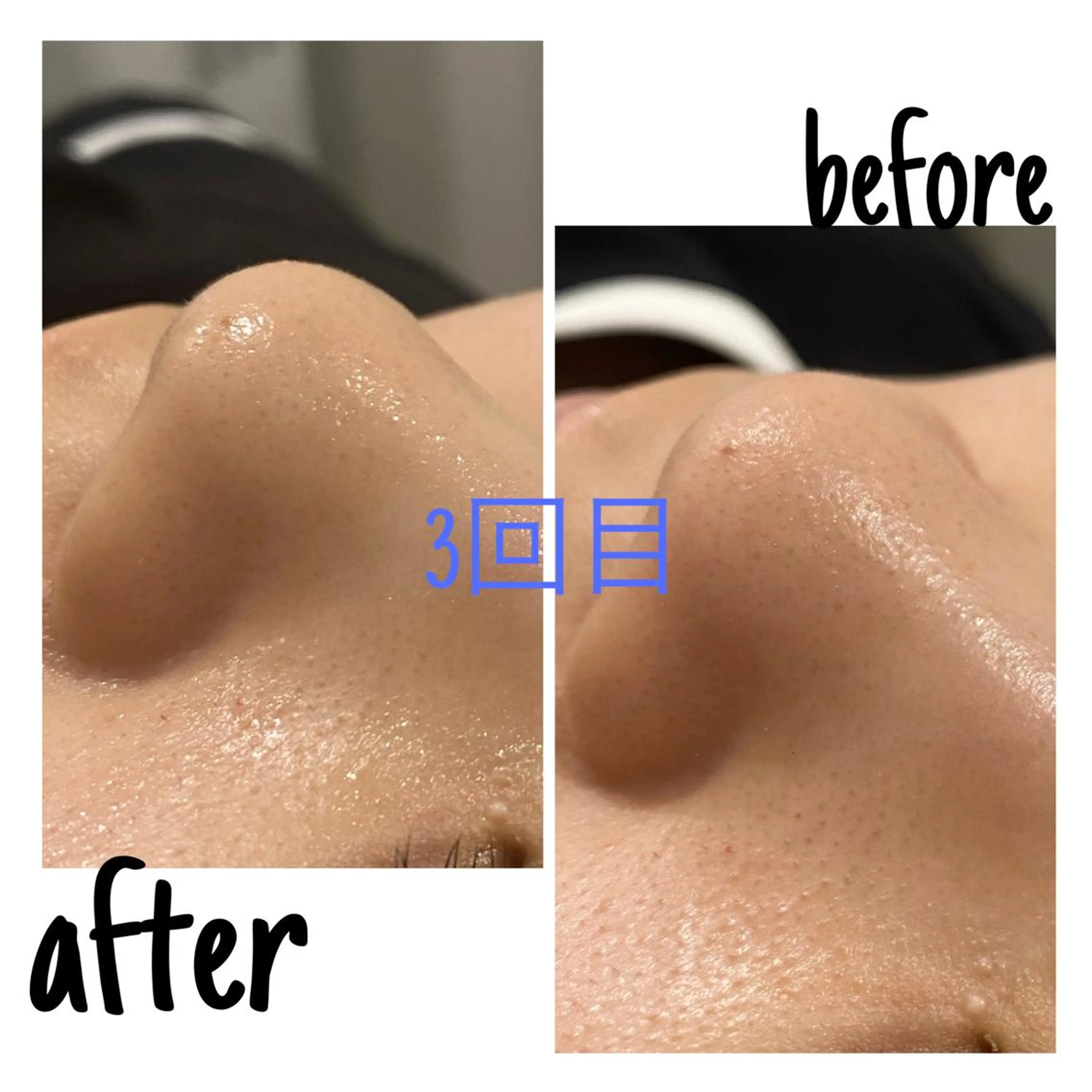 エステ 毛穴洗浄・痩身・脱毛 /アルカンジュのエステ・リラクイメージ