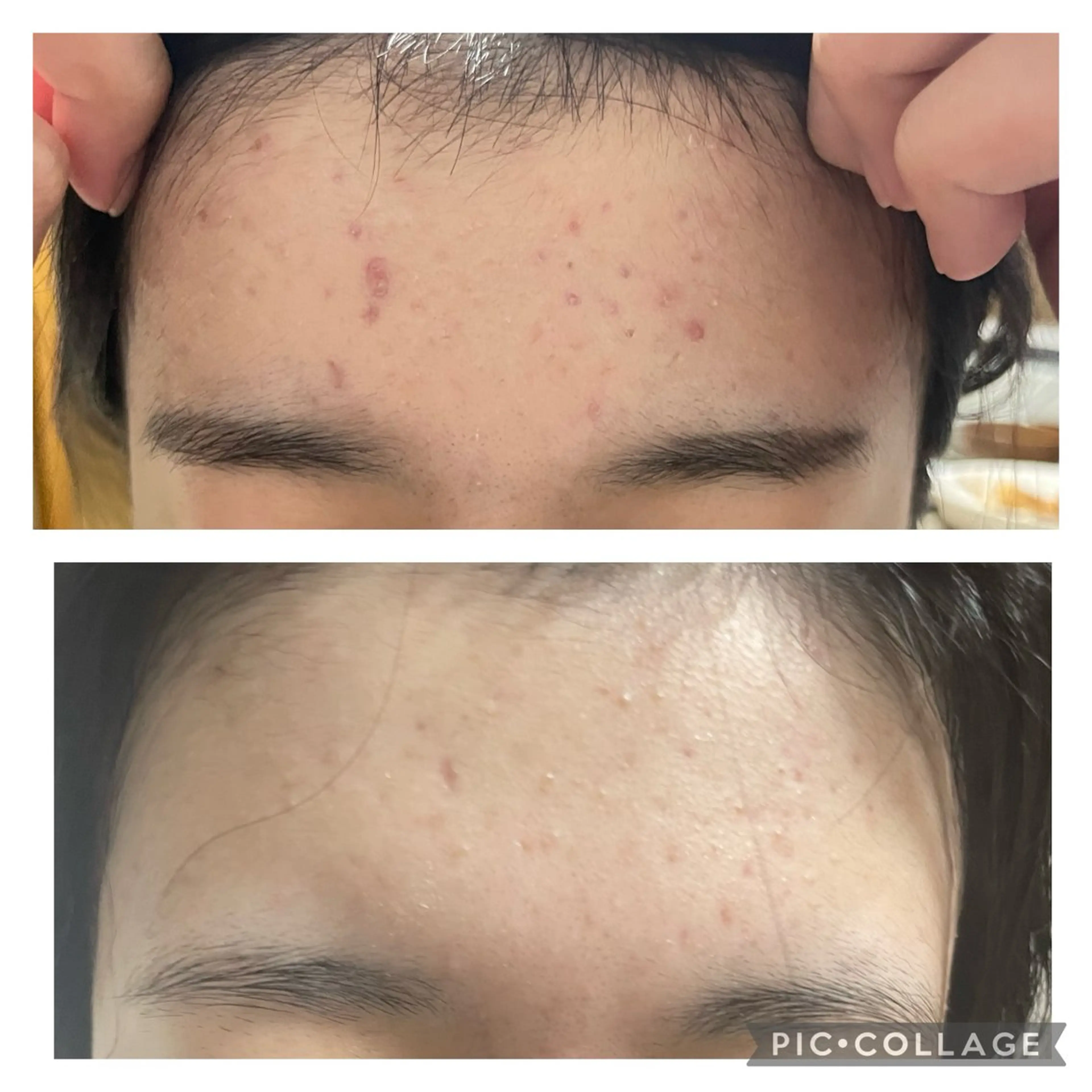 肌質改善🕊️ hirokoのエステ・リラクイメージ