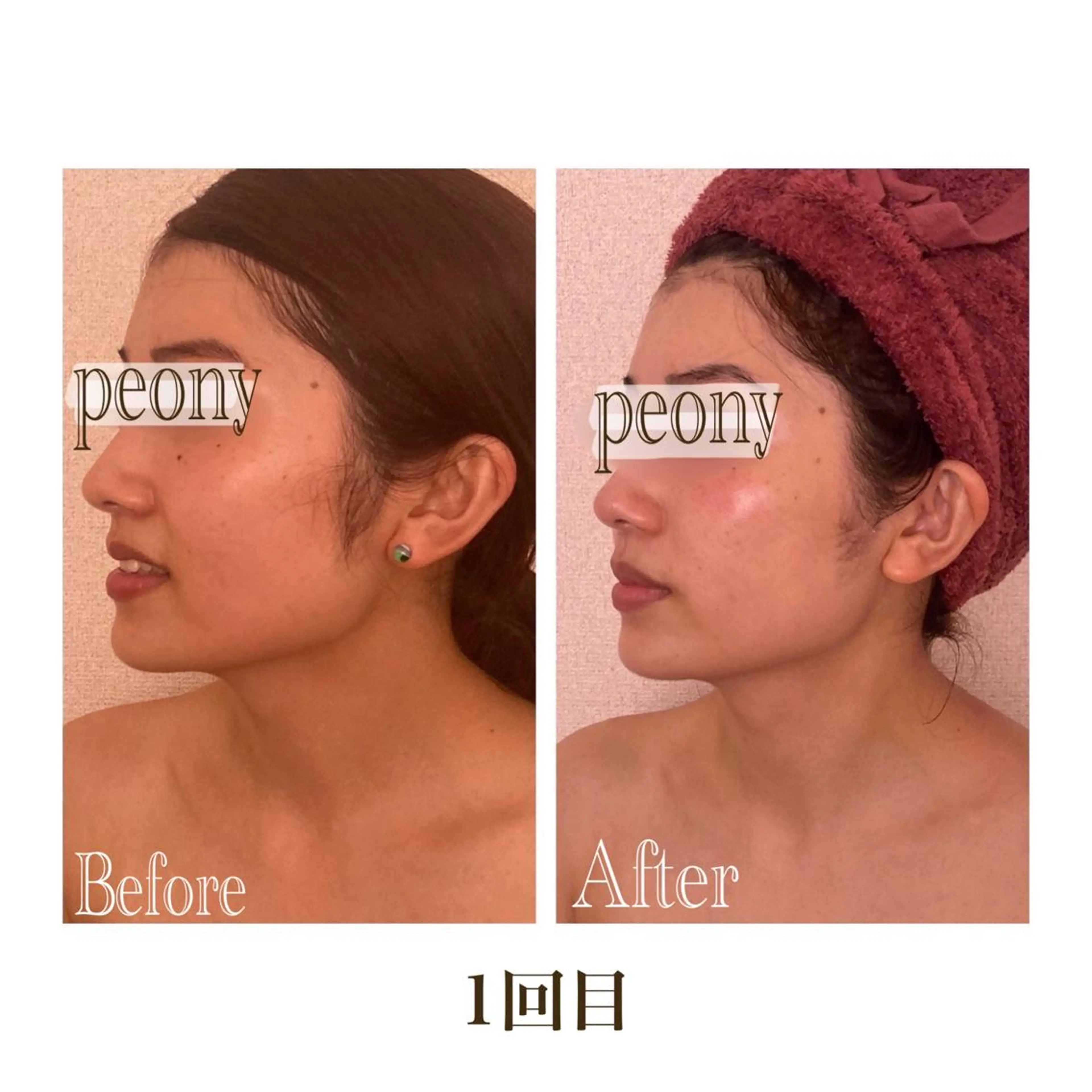 デトックス美容専門サロンｐｅｏｎｙ所属・デトックス美容専門 サロンｐｅｏｎｙのエステ・リラクイメージ