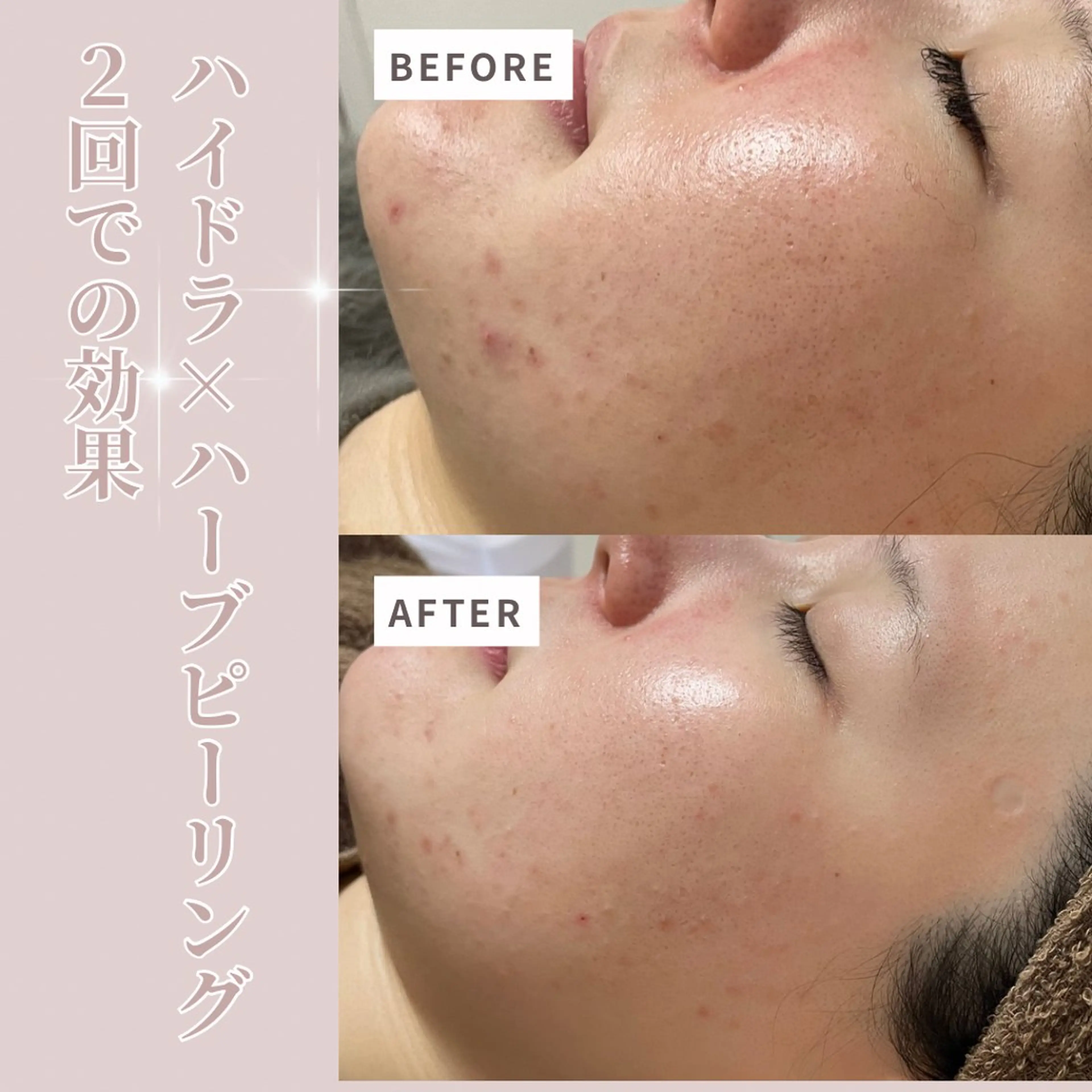 エステ プライベートサロン Belle（ベル）のエステ・リラクイメージ