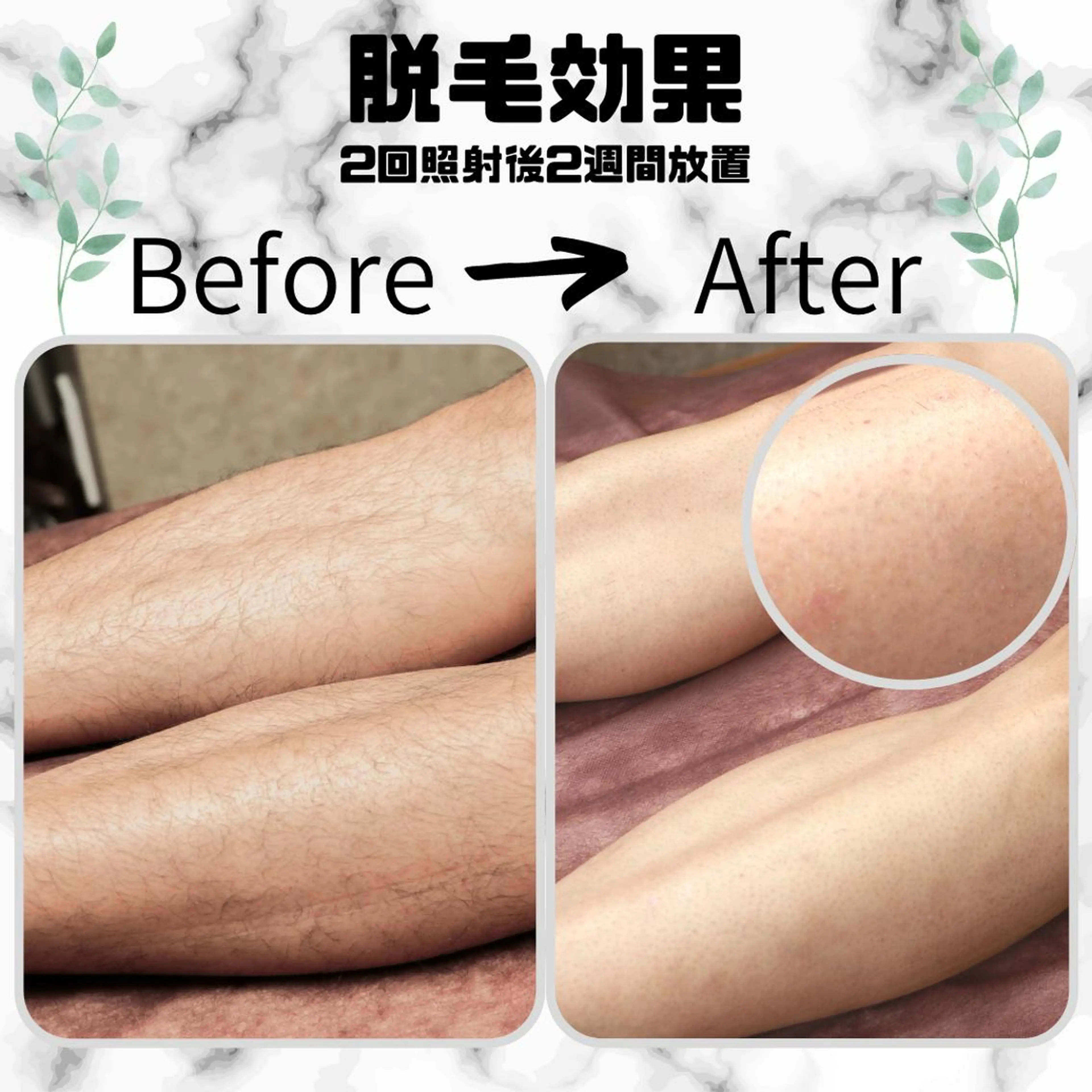 メンズ キッズ 男女同額完全個室脱毛 LEPIA内田のエステ・リラクイメージ