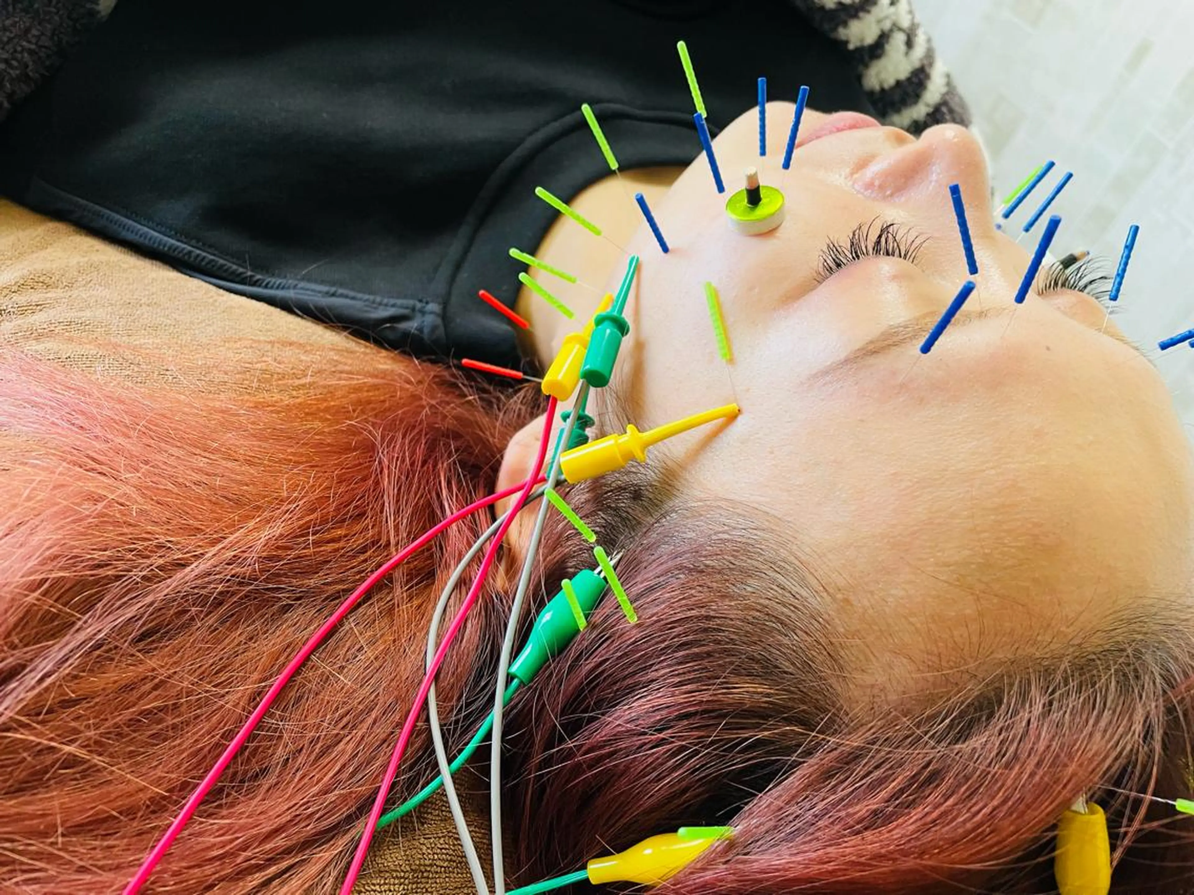 美容鍼灸サロン mahoroba院長のエステ・リラクイメージ