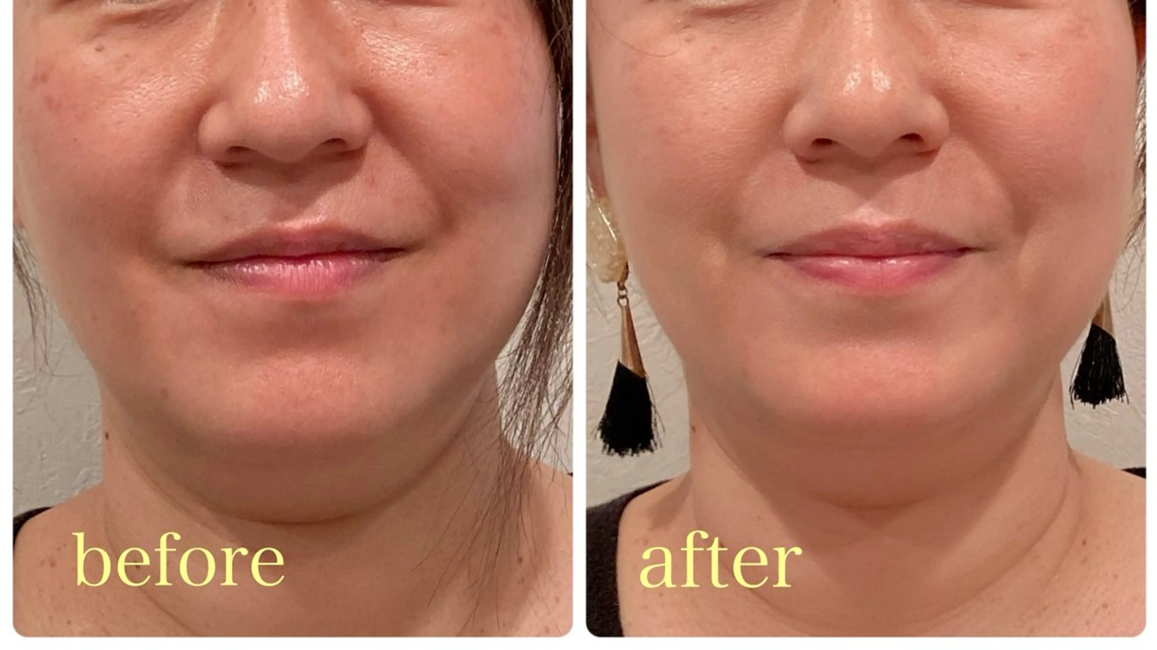 エステ リラク 小顔×肌質改善サロン soin〔ソワン〕のエステ・リラクイメージ