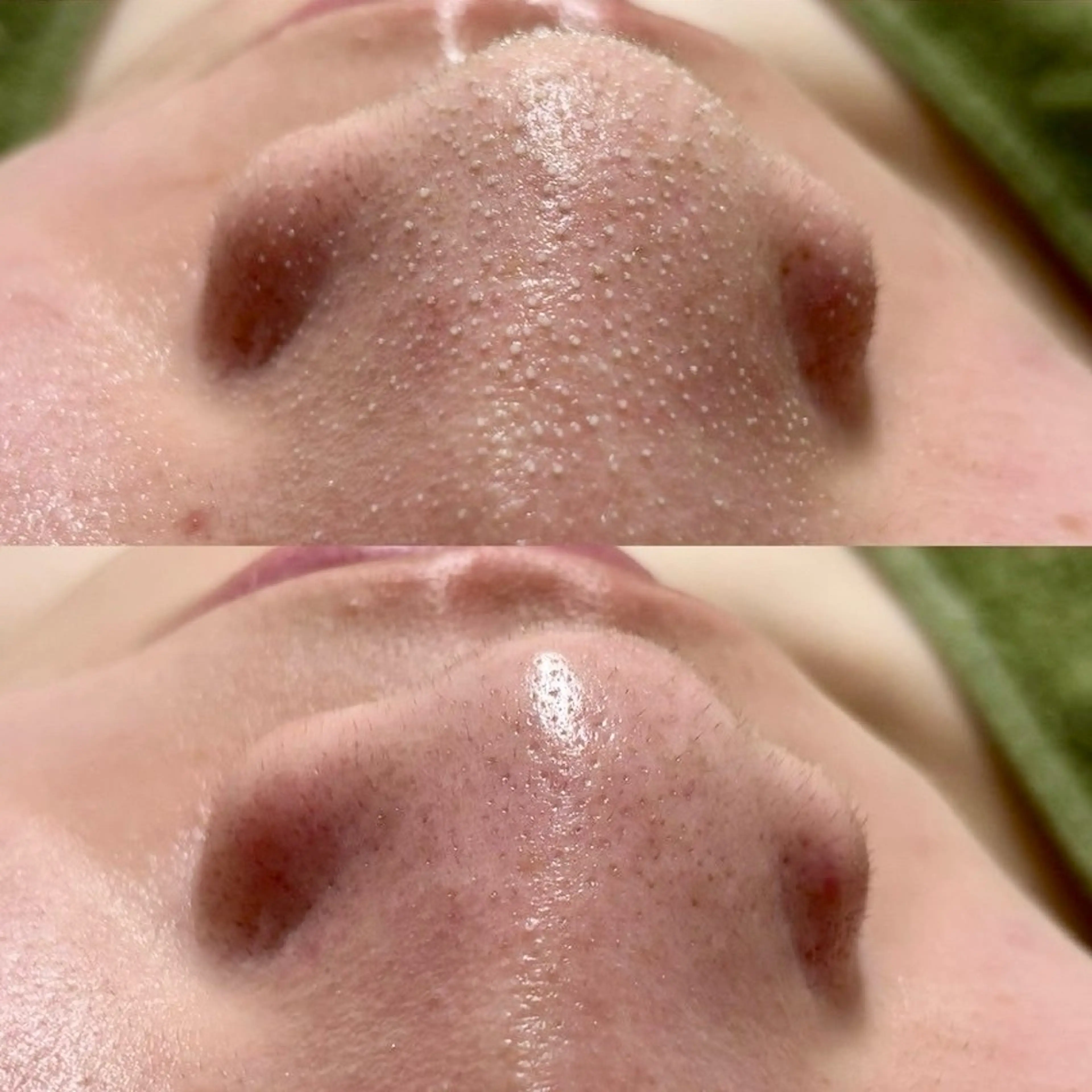 エステ フェイシャル/脱毛 ジョアアンジェ竹田のエステ・リラクイメージ