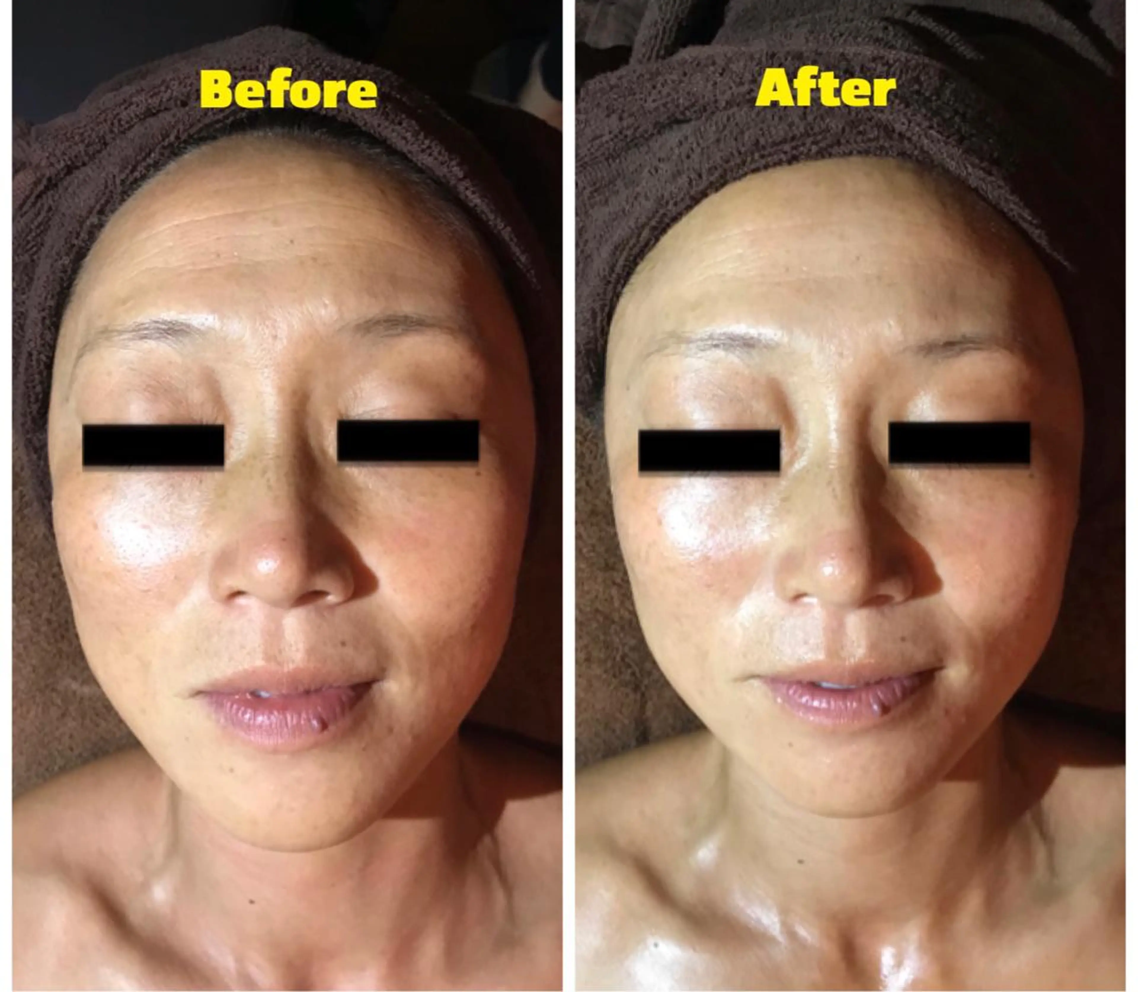 代表 MOMOのエステ・リラクイメージ