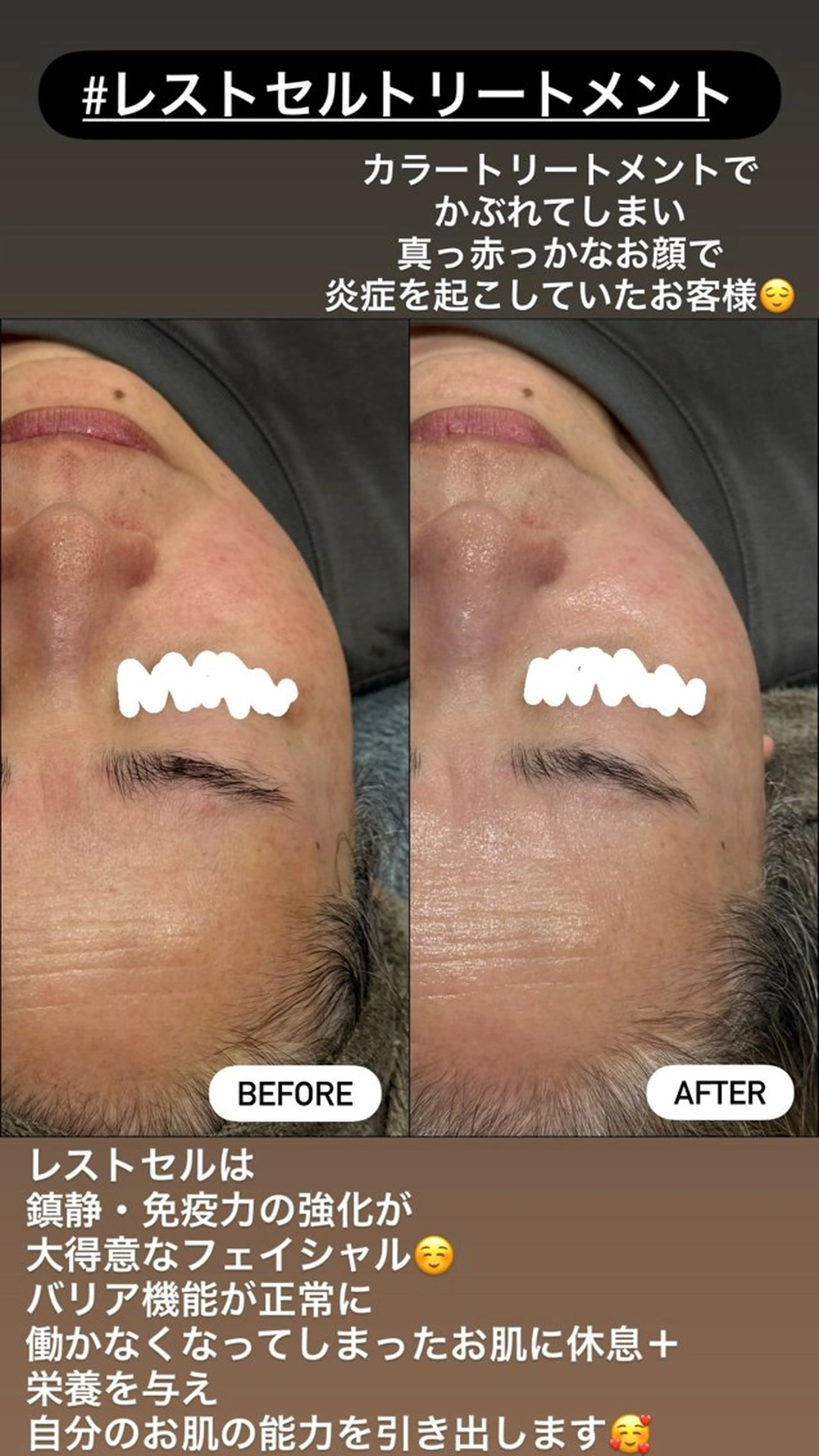 エステ LiZA エステティックサロンのエステ・リラクイメージ