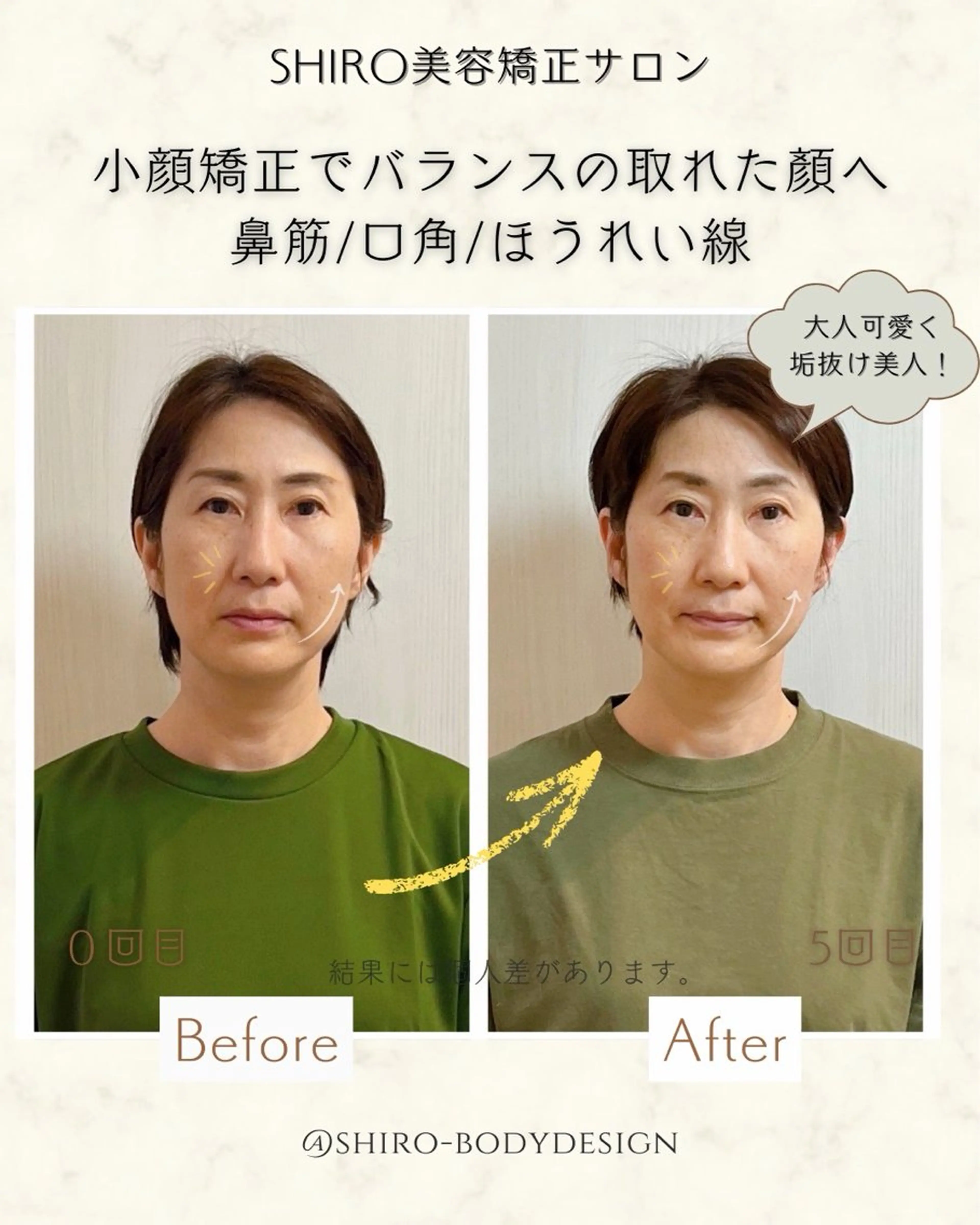 小顔美容矯正勝山式 shiroしろのエステ・リラクイメージ