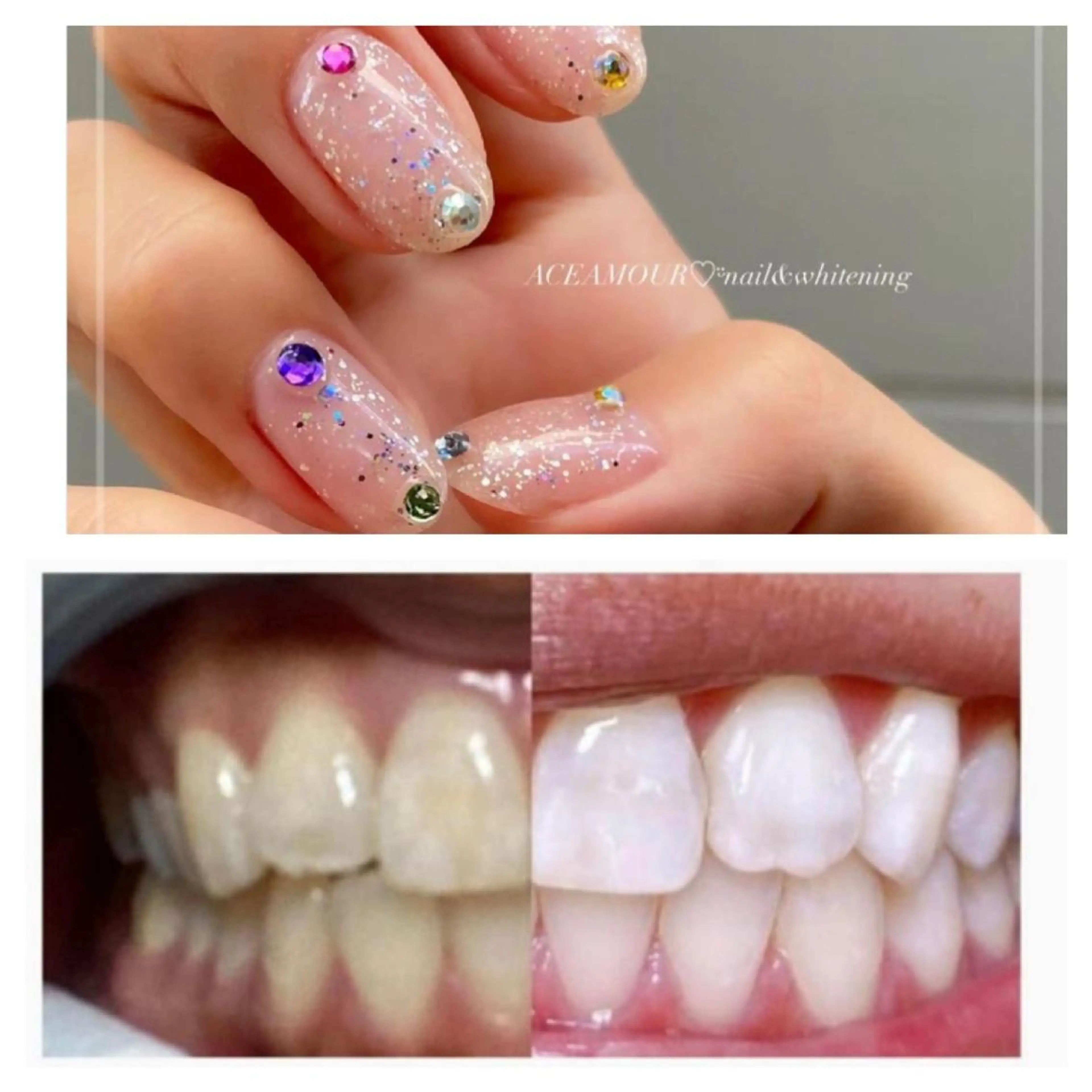 ネイル ネイル/耳つぼ /新ホワイトニングのネイルデザイン